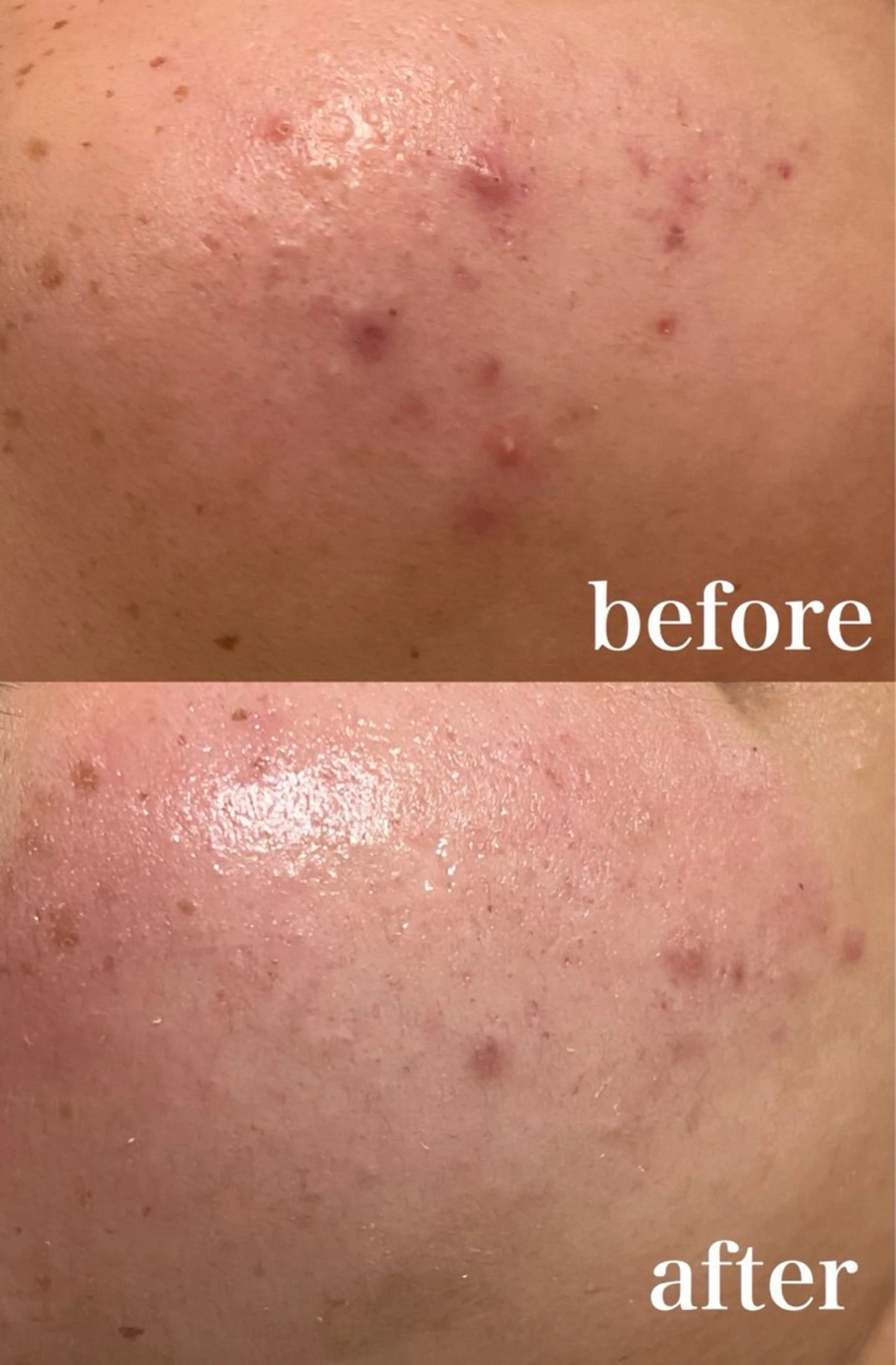 mignon /まつげパーマ・小顔のマツエク・マツパデザイン