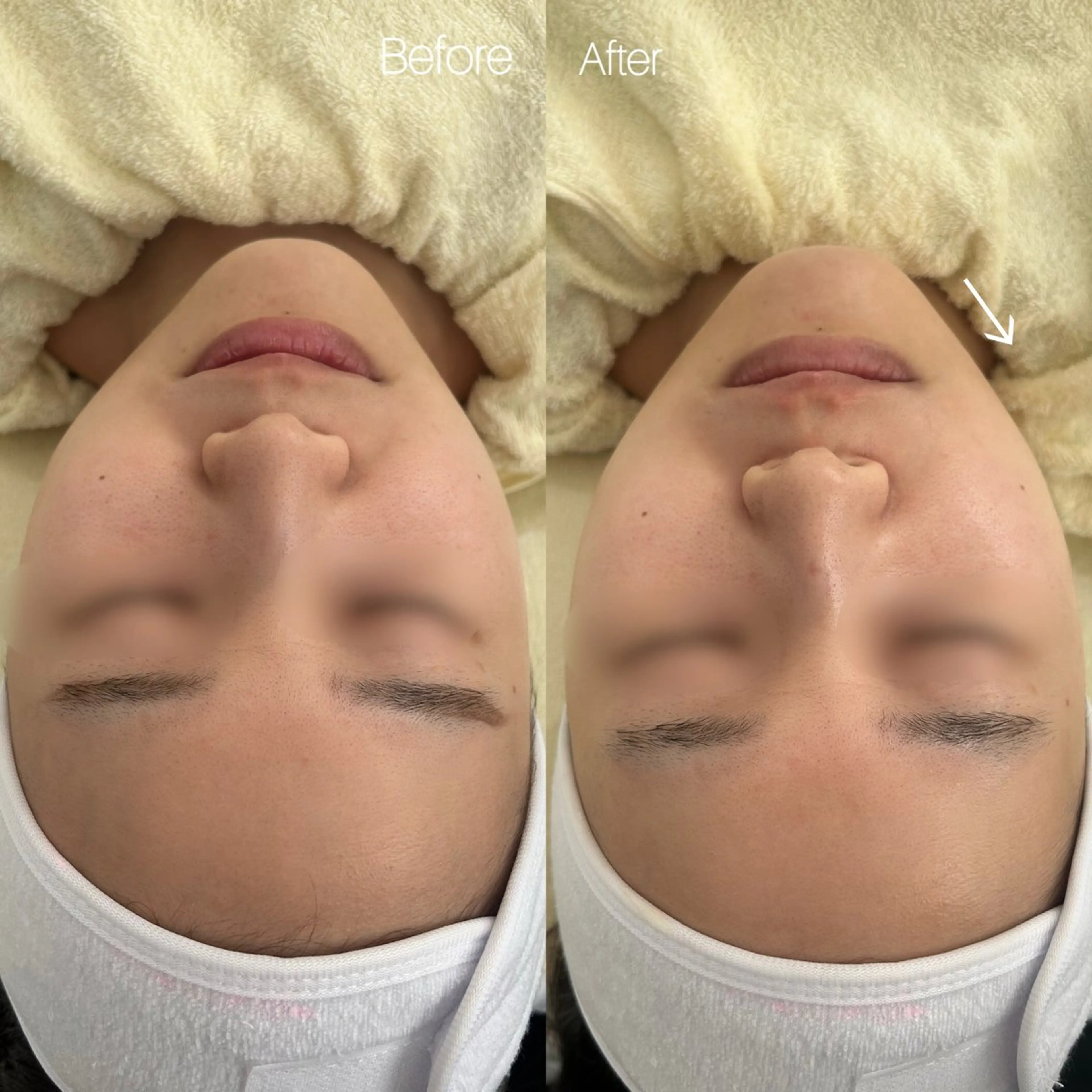 〈etre〉トータルビューティーサロン所属・etre - 韓国肌管理 -のエステ・リラクイメージ