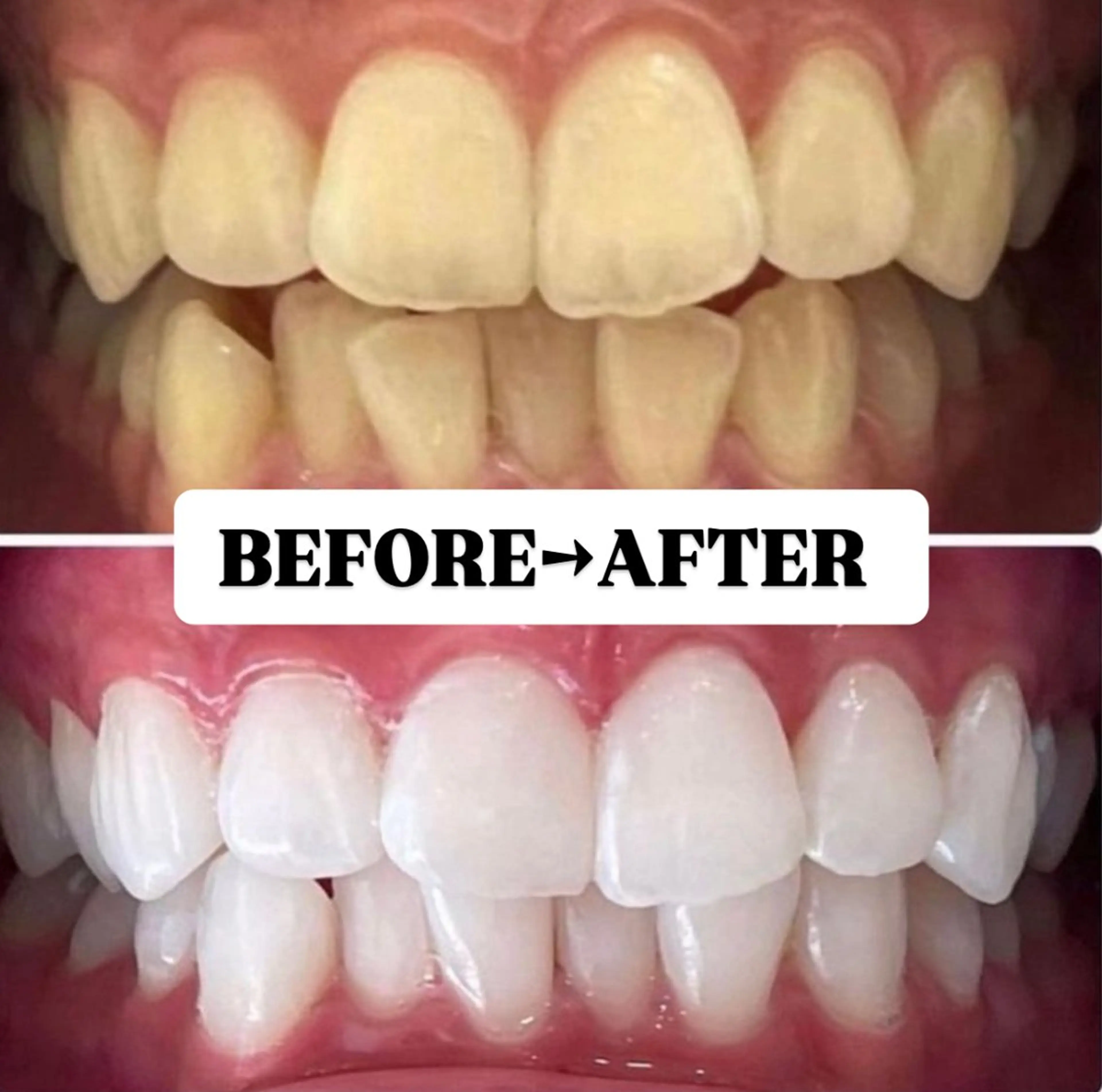 【まずはご相談されたい方☆】ホワイトニング無料カウンセリング¥0の写真