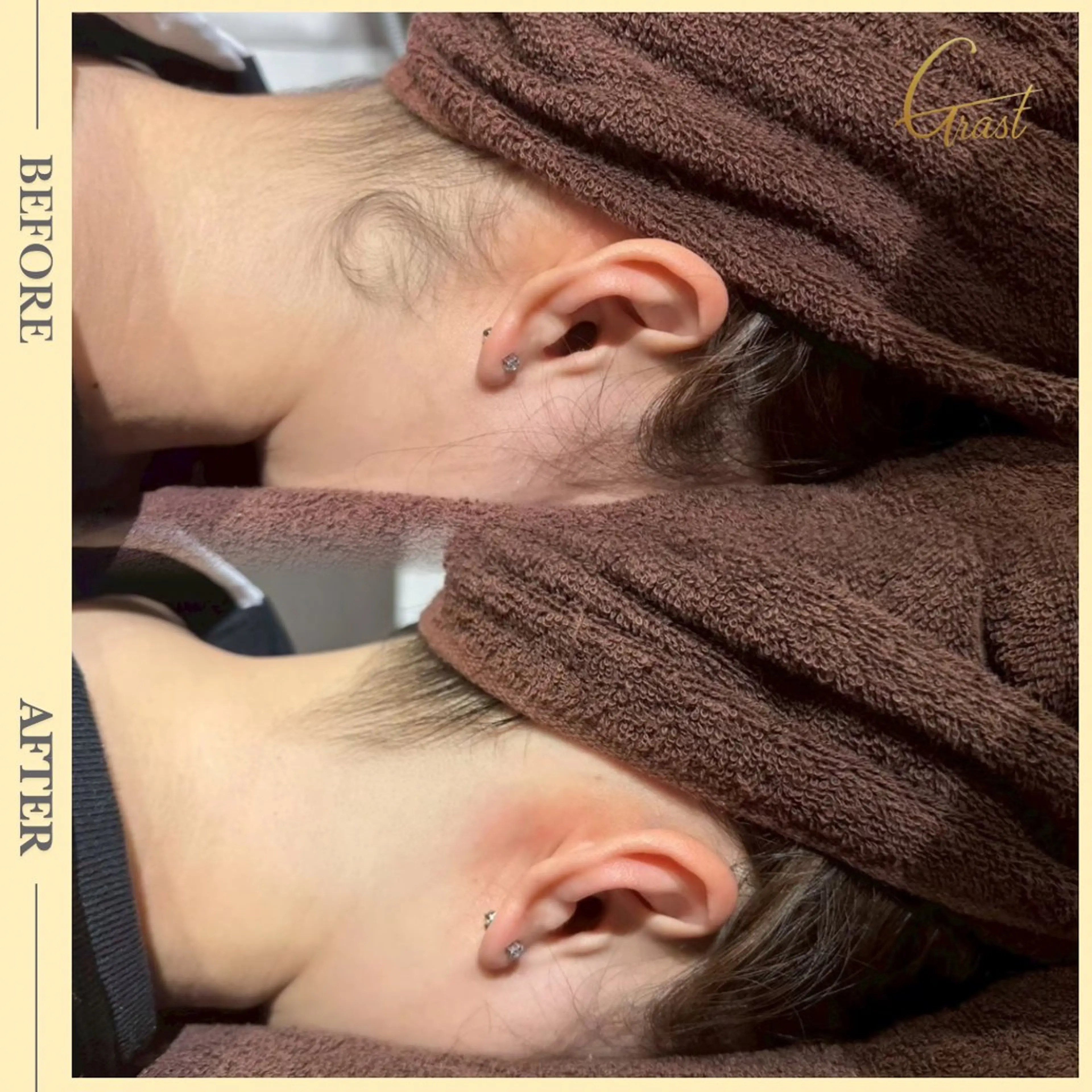 ツヤ肌脱毛サロン Grast🌿アイカのエステ・リラクイメージ