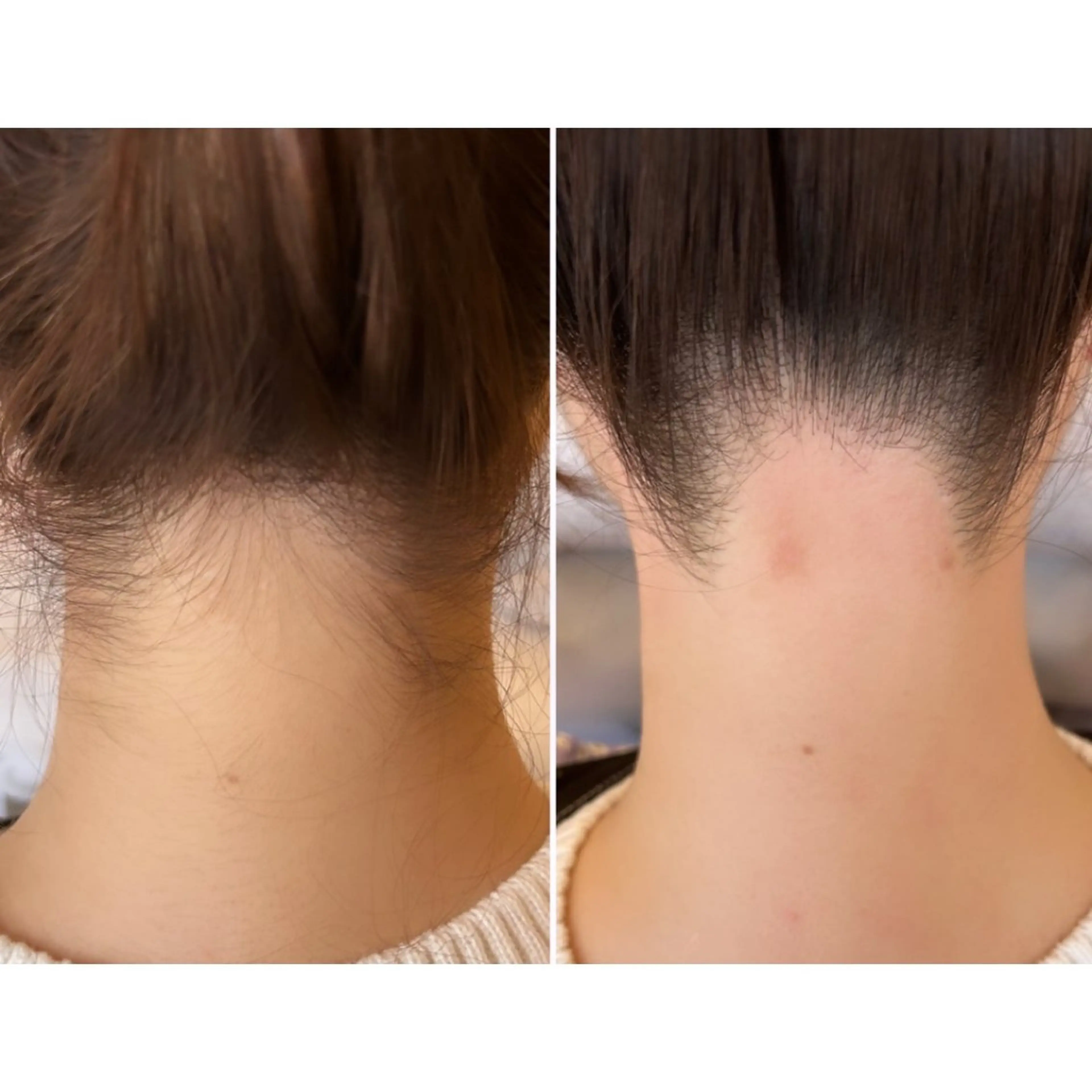 セミロング ワックス脱毛🌈 ESPOIRnocoのエステ・リラクイメージ