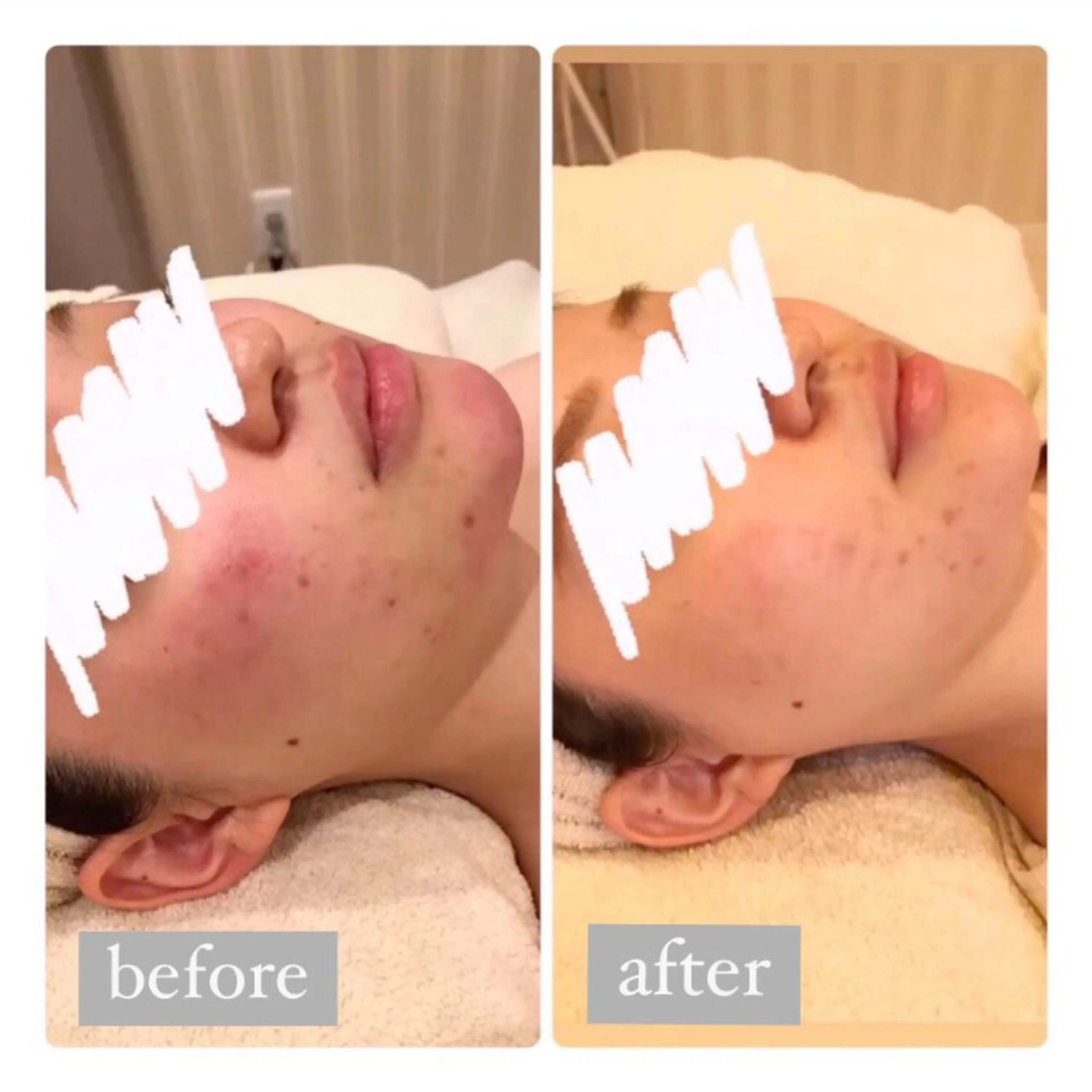 美肌脱毛専門サロン Dione栄店のエステ・リラクイメージ