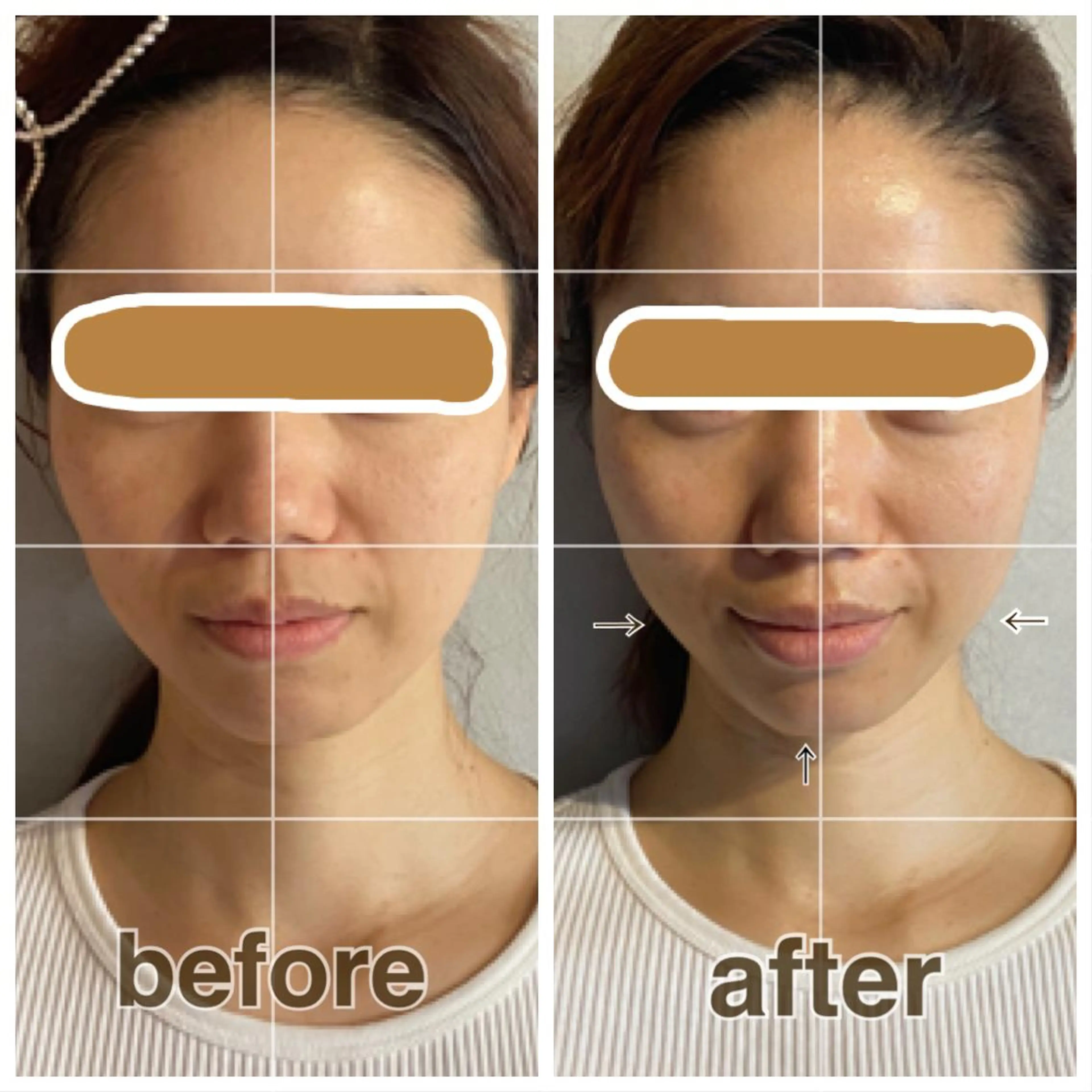 【小顔矯正】 salonaceのエステ・リラクイメージ