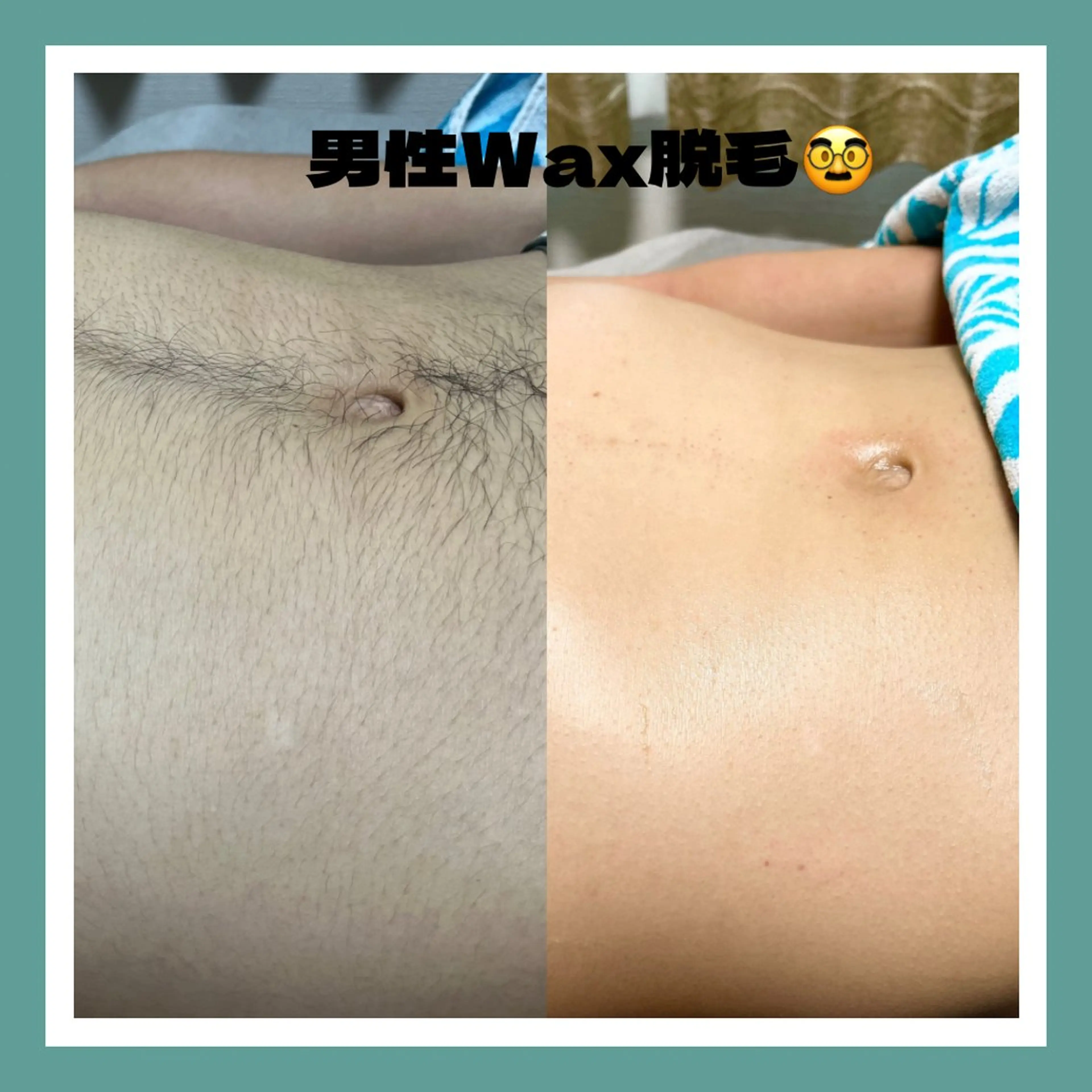 メンズ 脱毛 kaise makiのエステ・リラクイメージ