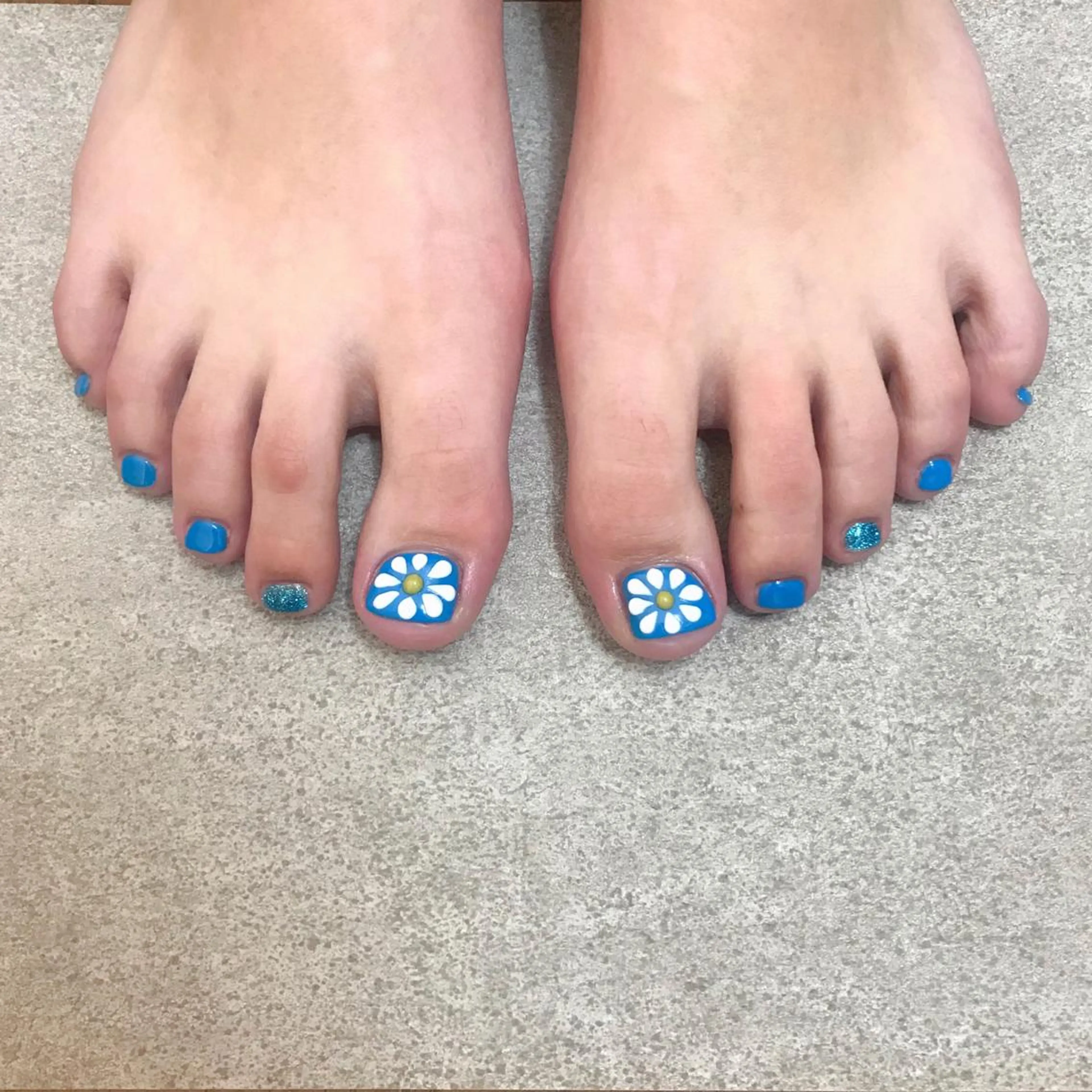 フット 2本アート(オフ込み)の写真