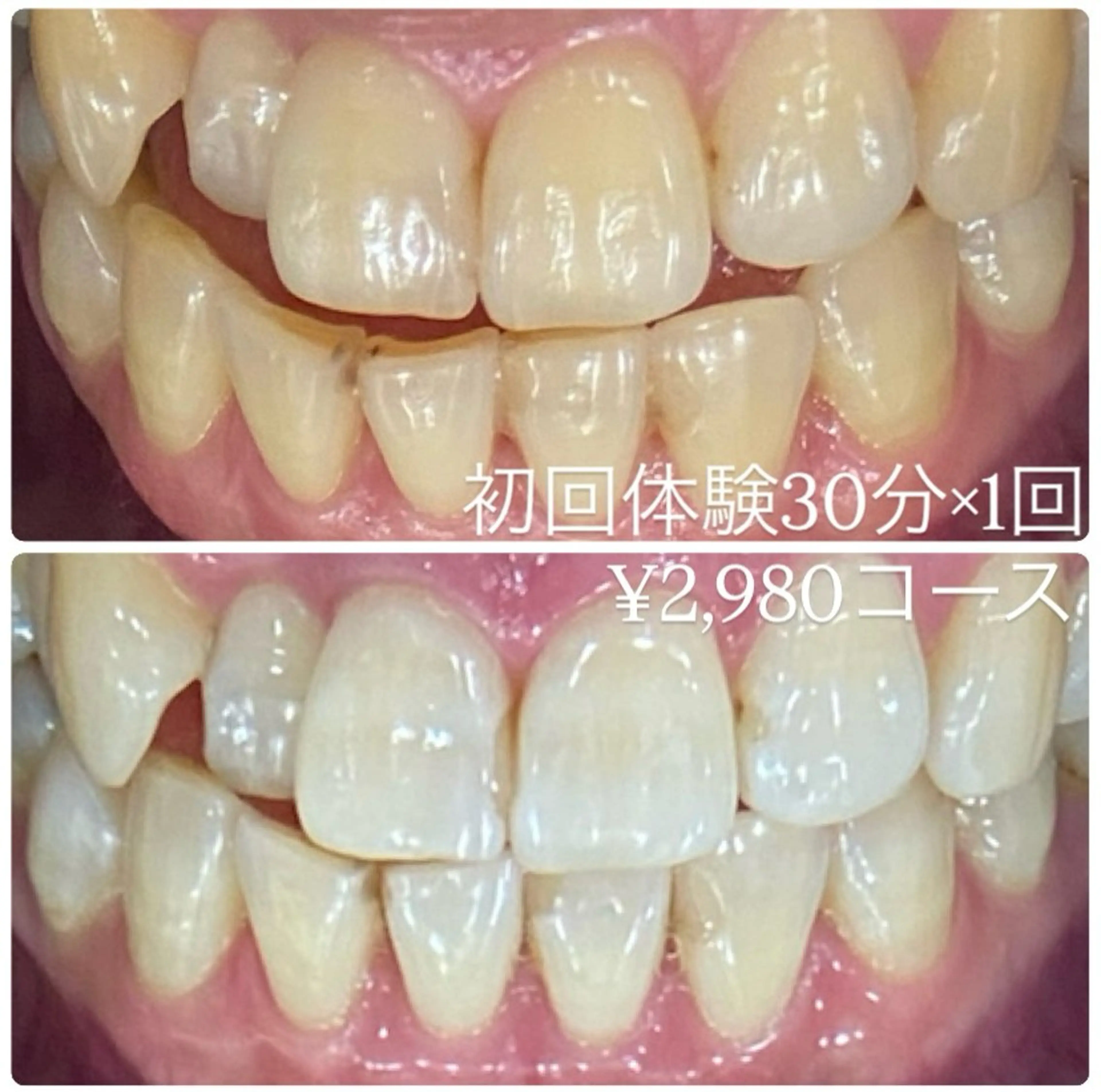 ホワイトニングルーム 横浜店のその他イメージ