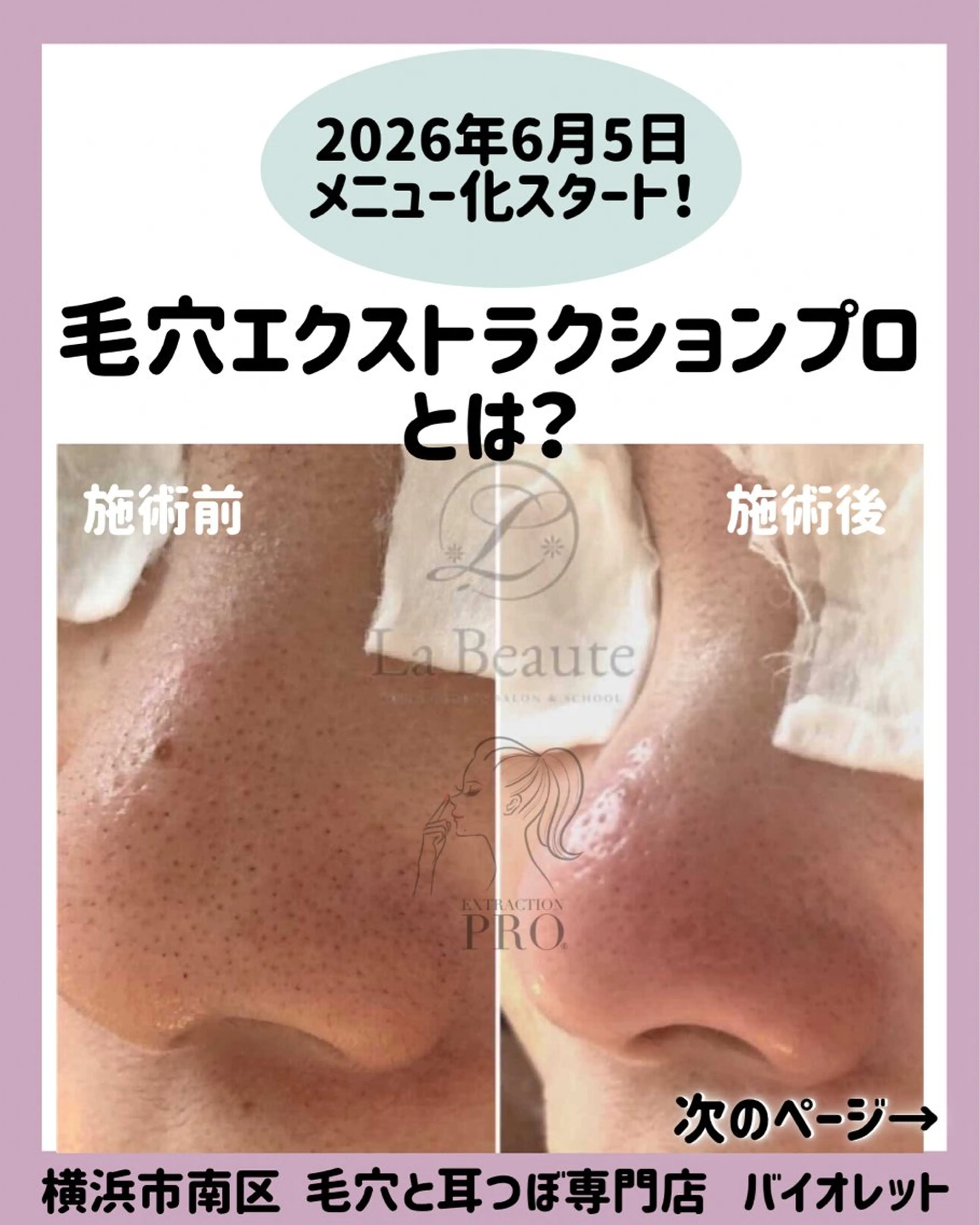 毛穴と耳つぼ専門店 バイオレット　りののその他イメージ