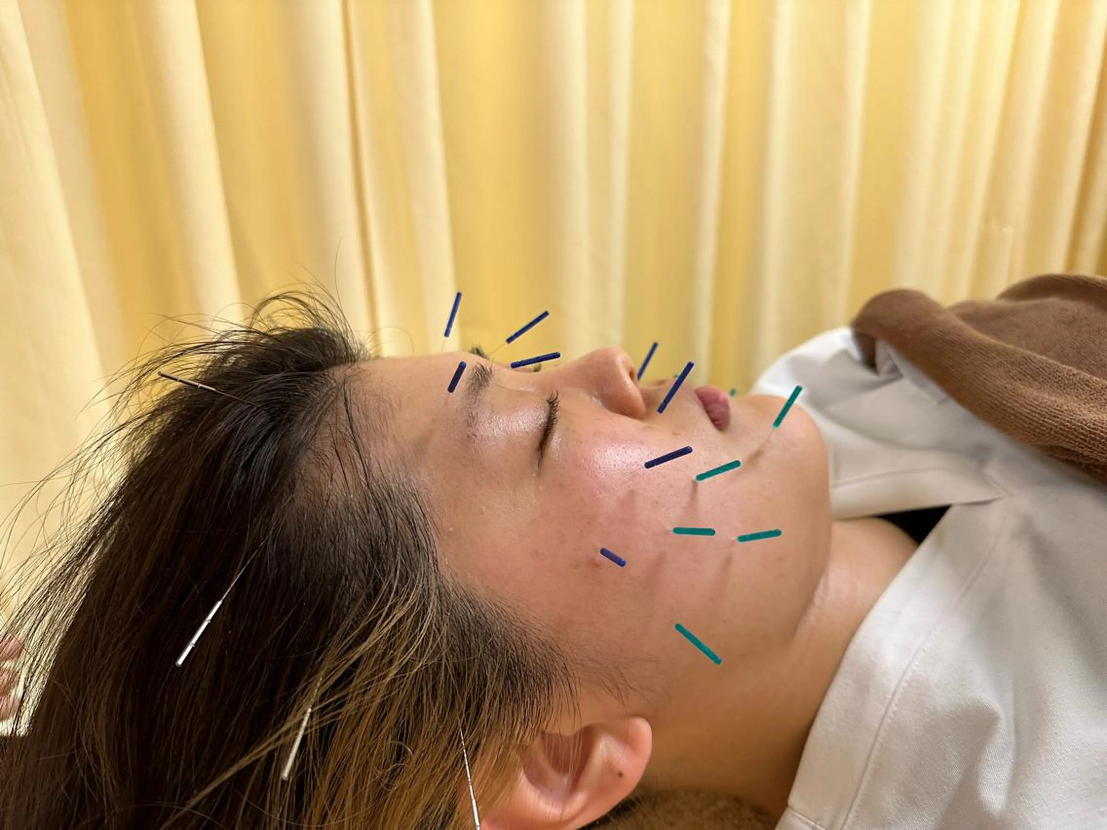 その他 鍼灸サロン BBB3のその他イメージ