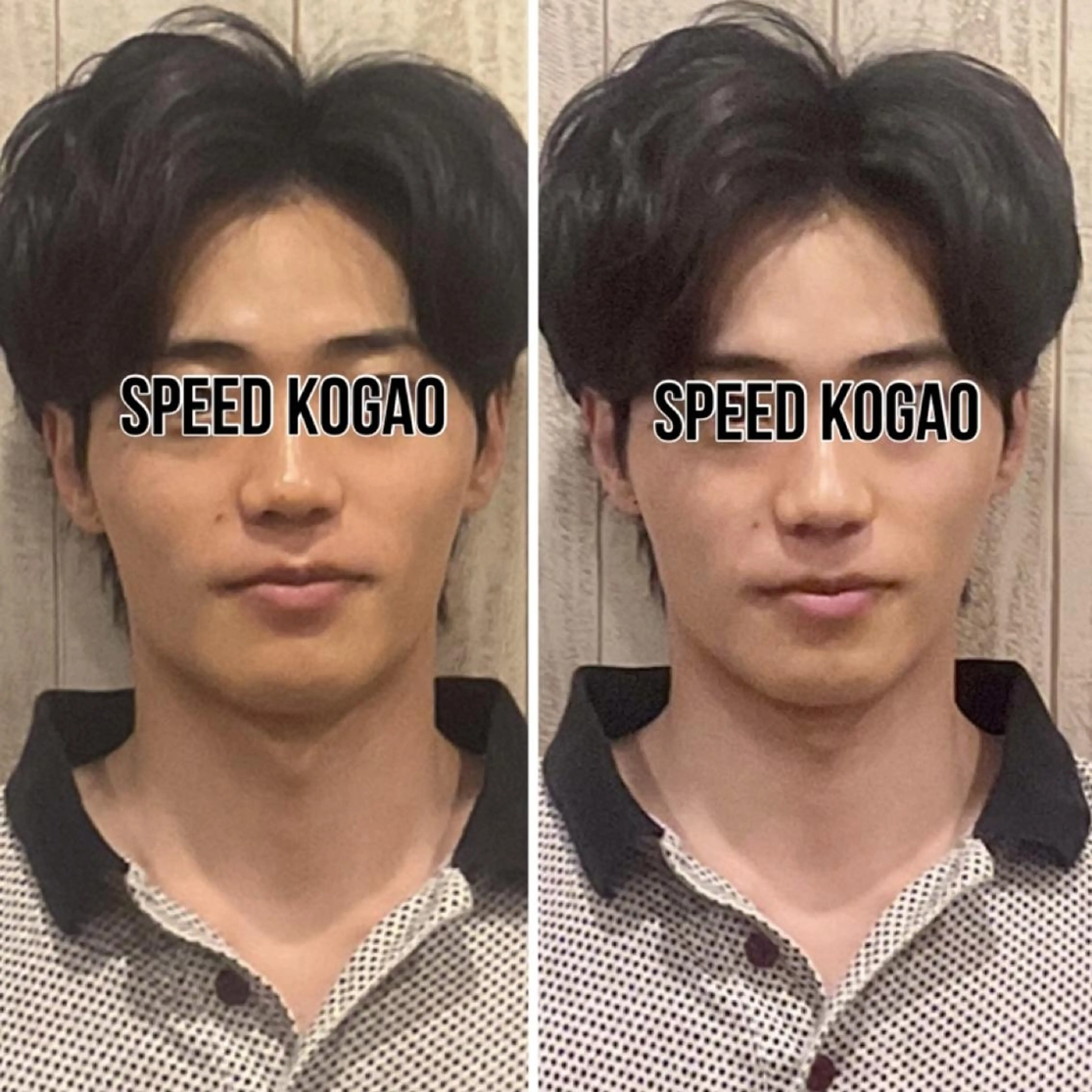 【メンズ限定】小顔矯正×毛穴洗浄🫧顎細Vライン✨保湿ピーリング垢抜け《顔痩せ/浮腫み/ザラつき/ニキビ/肌荒れ/乾燥》の写真