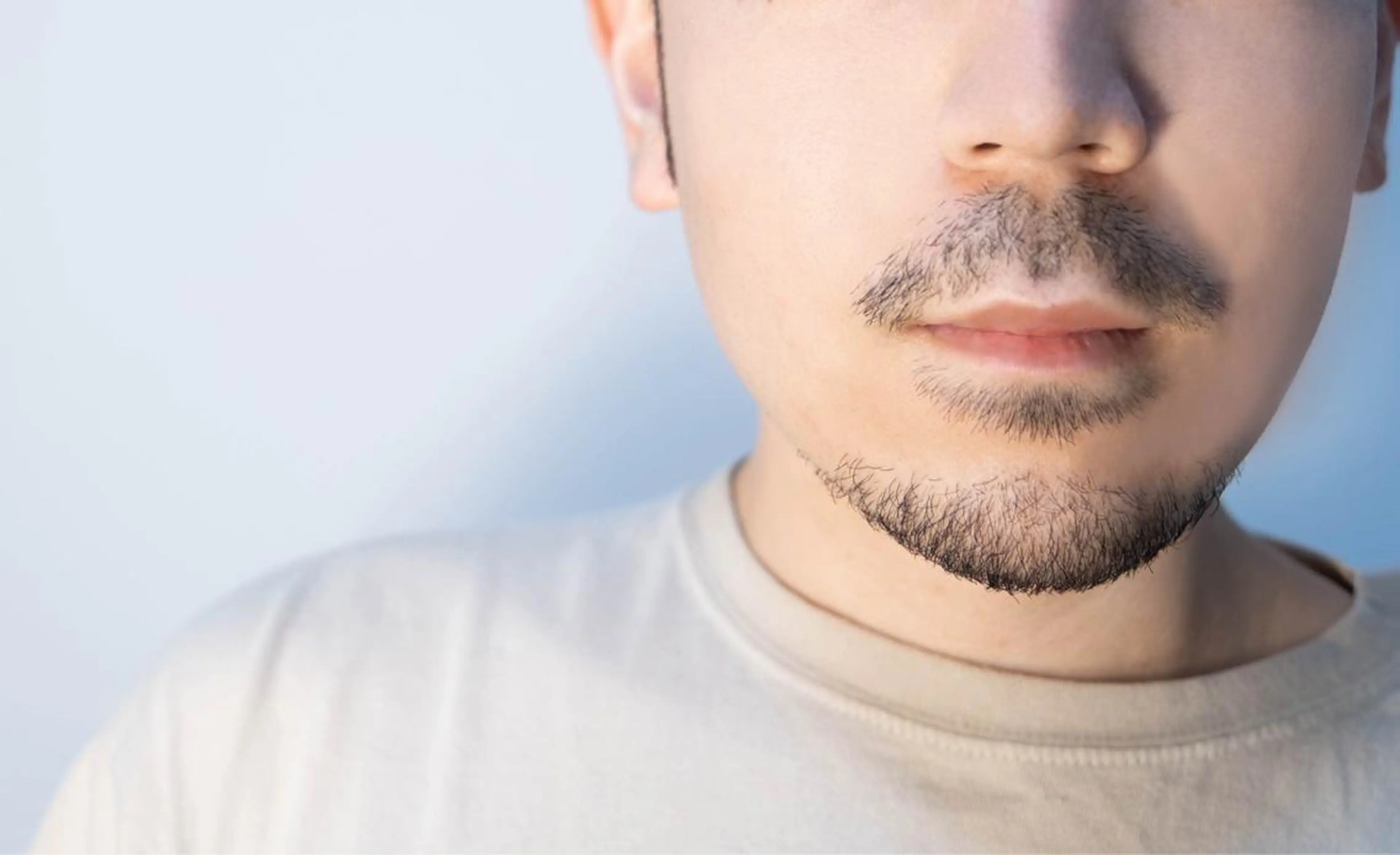 【メンズ応援⭐️】ヒゲ脱毛🧔🏻‍♂️ 《新規限定》50%OFFの写真