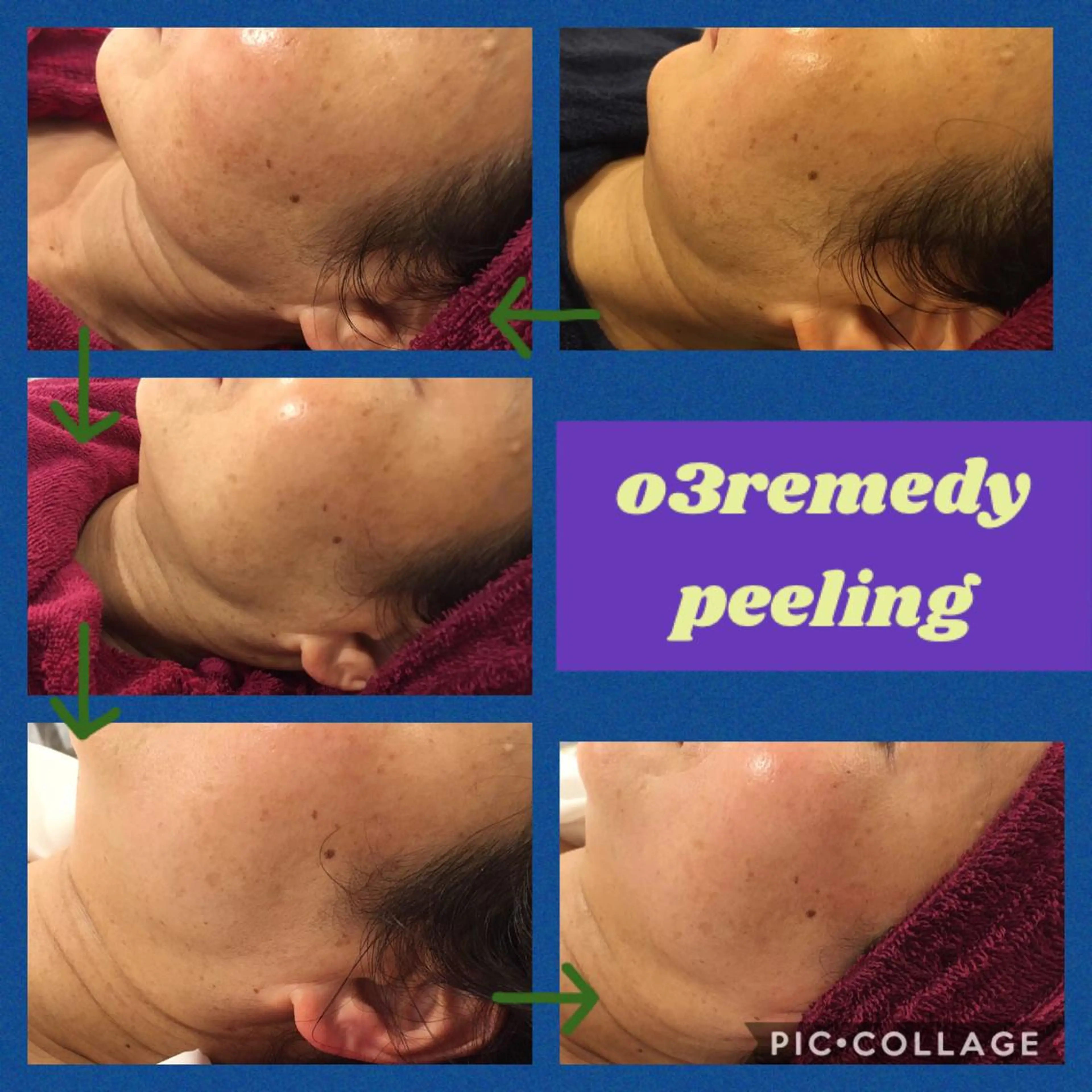 エステ 宇野澤 彩加のエステ・リラクイメージ