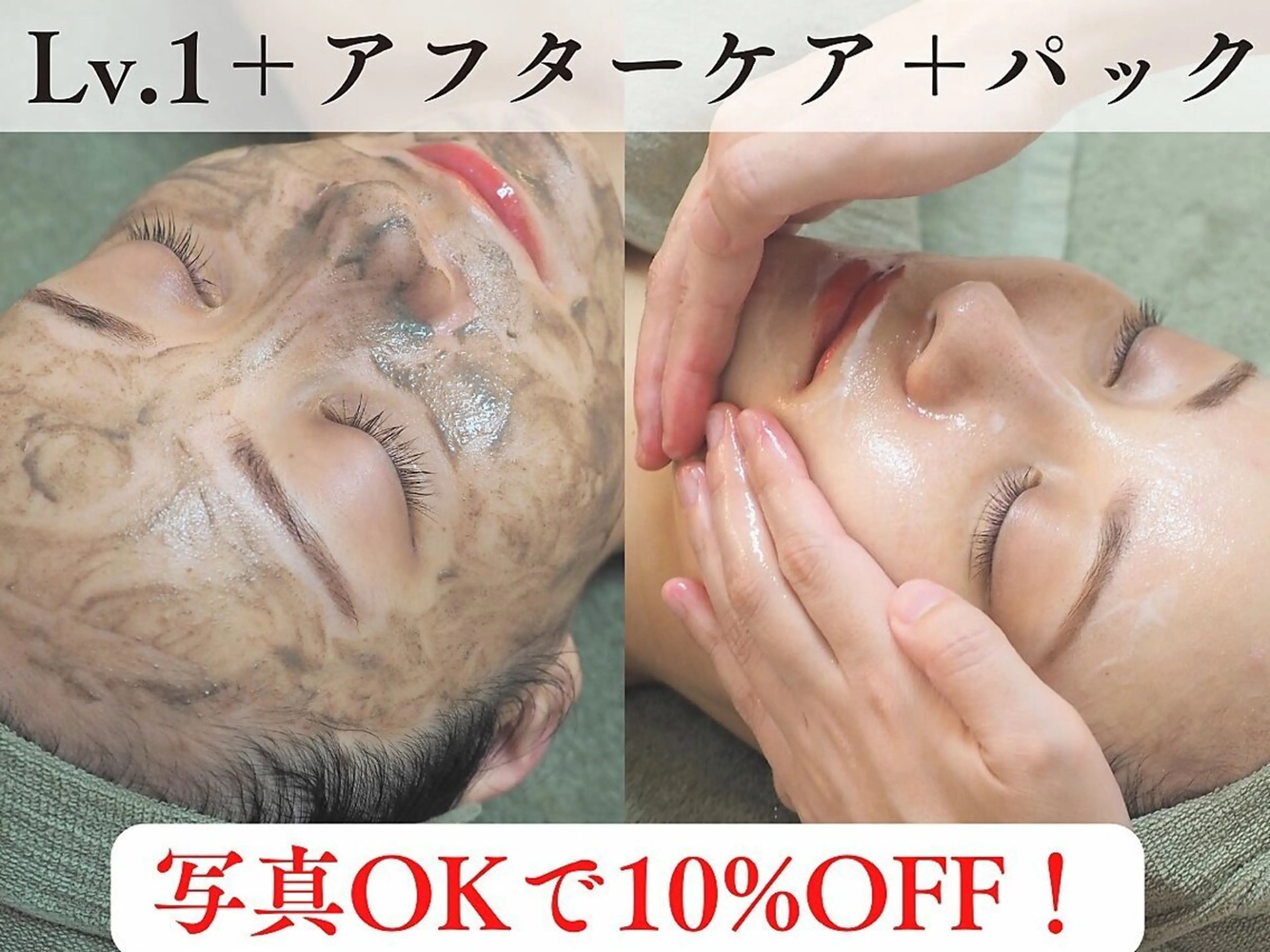 ■人気NO.1■ハーブピーリング[剥離なし約10回分の効果]ニキビケア/毛穴ケア¥35,100の写真