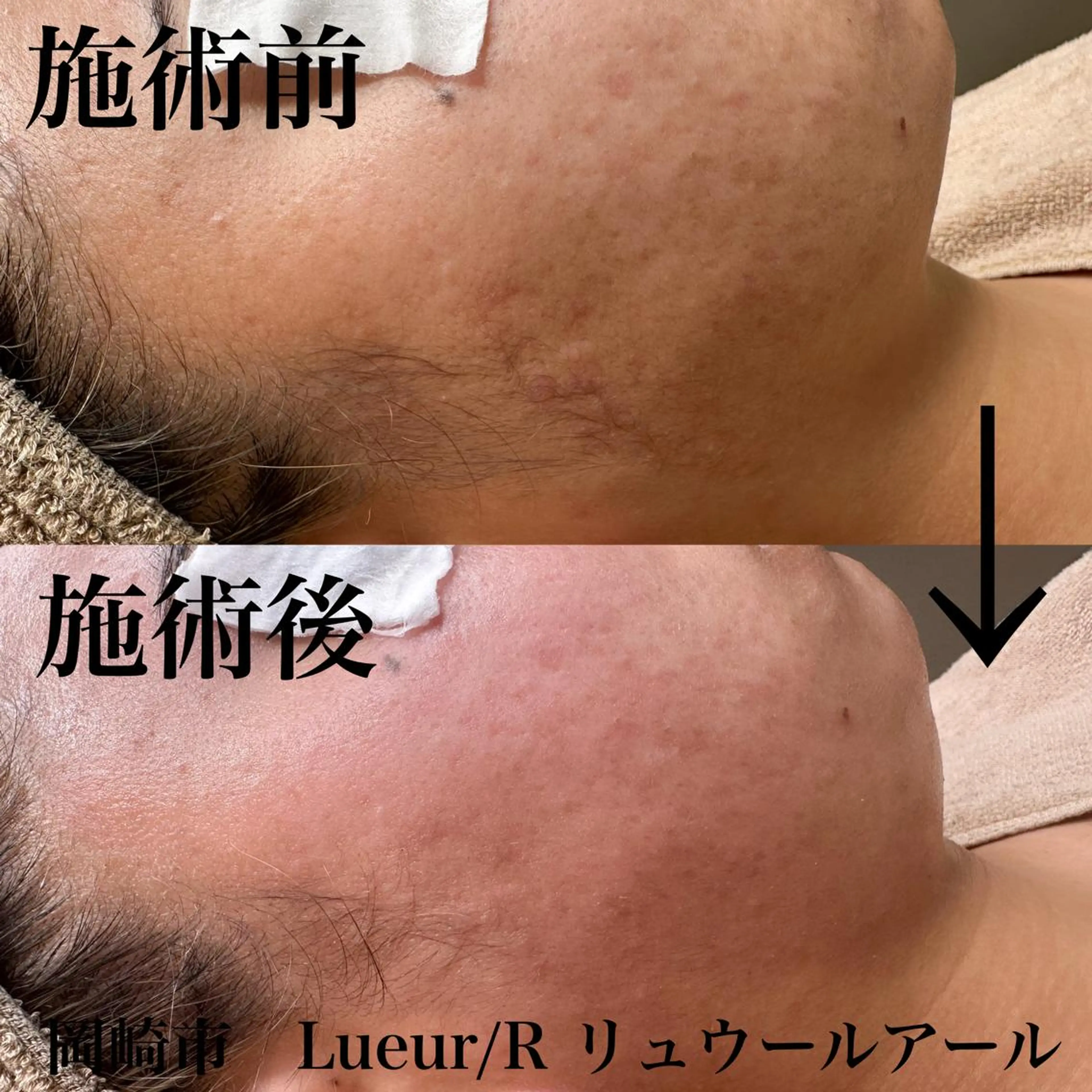 その他 大久保 里奈のエステ・リラクイメージ