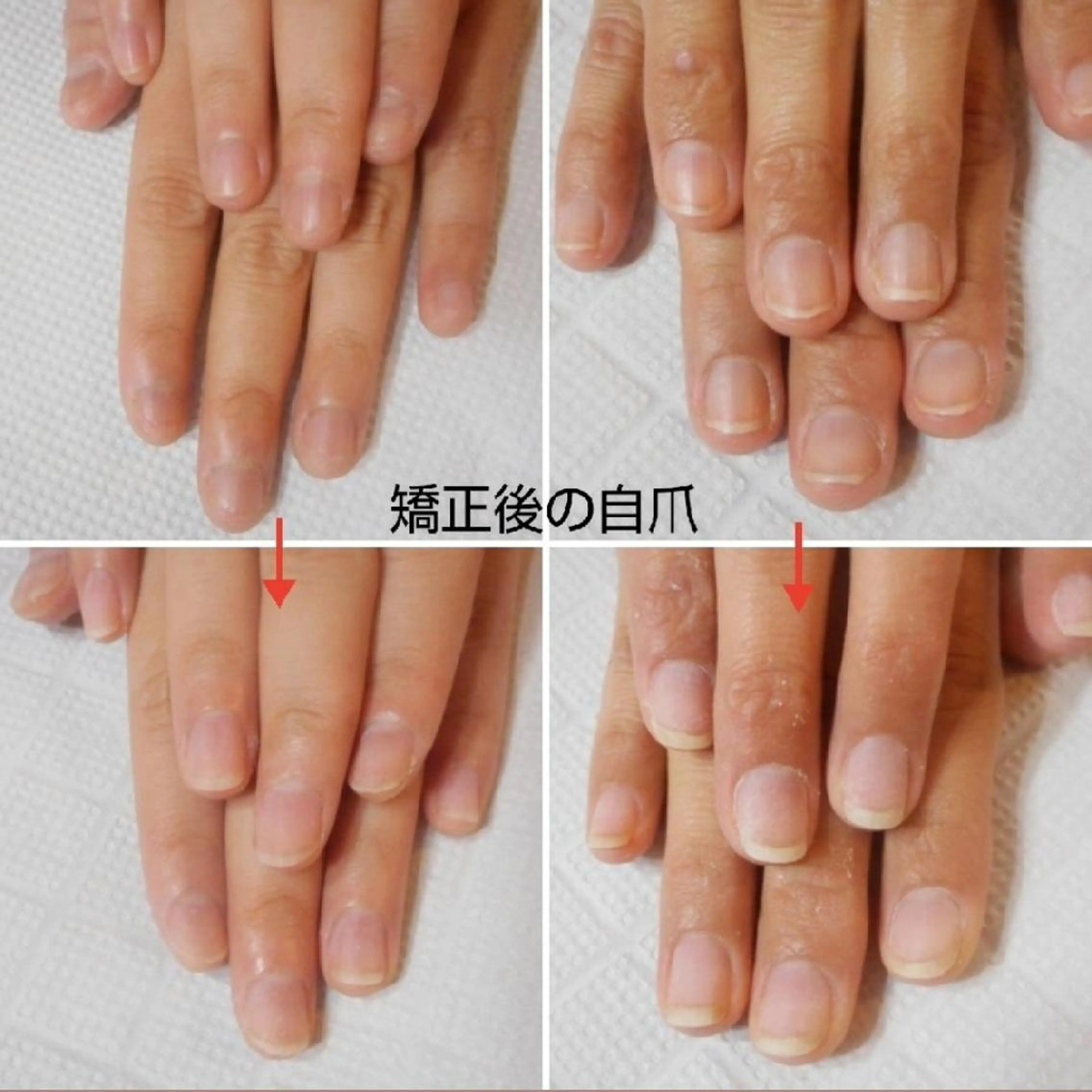 ネイル ネイルサロン アリュームのネイルデザイン