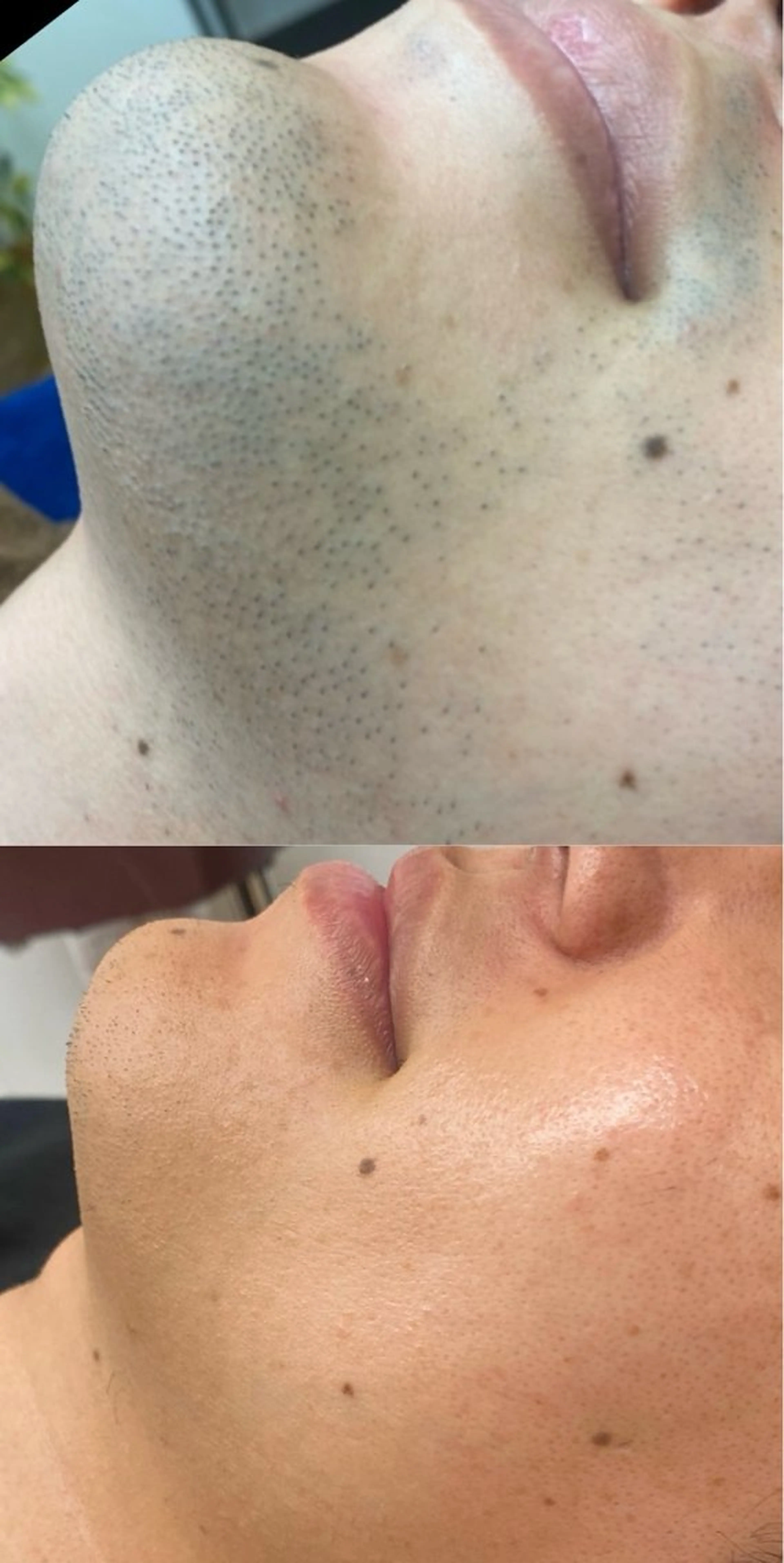 メンズ RE:moom リムーム/脱毛エステのエステ・リラクイメージ