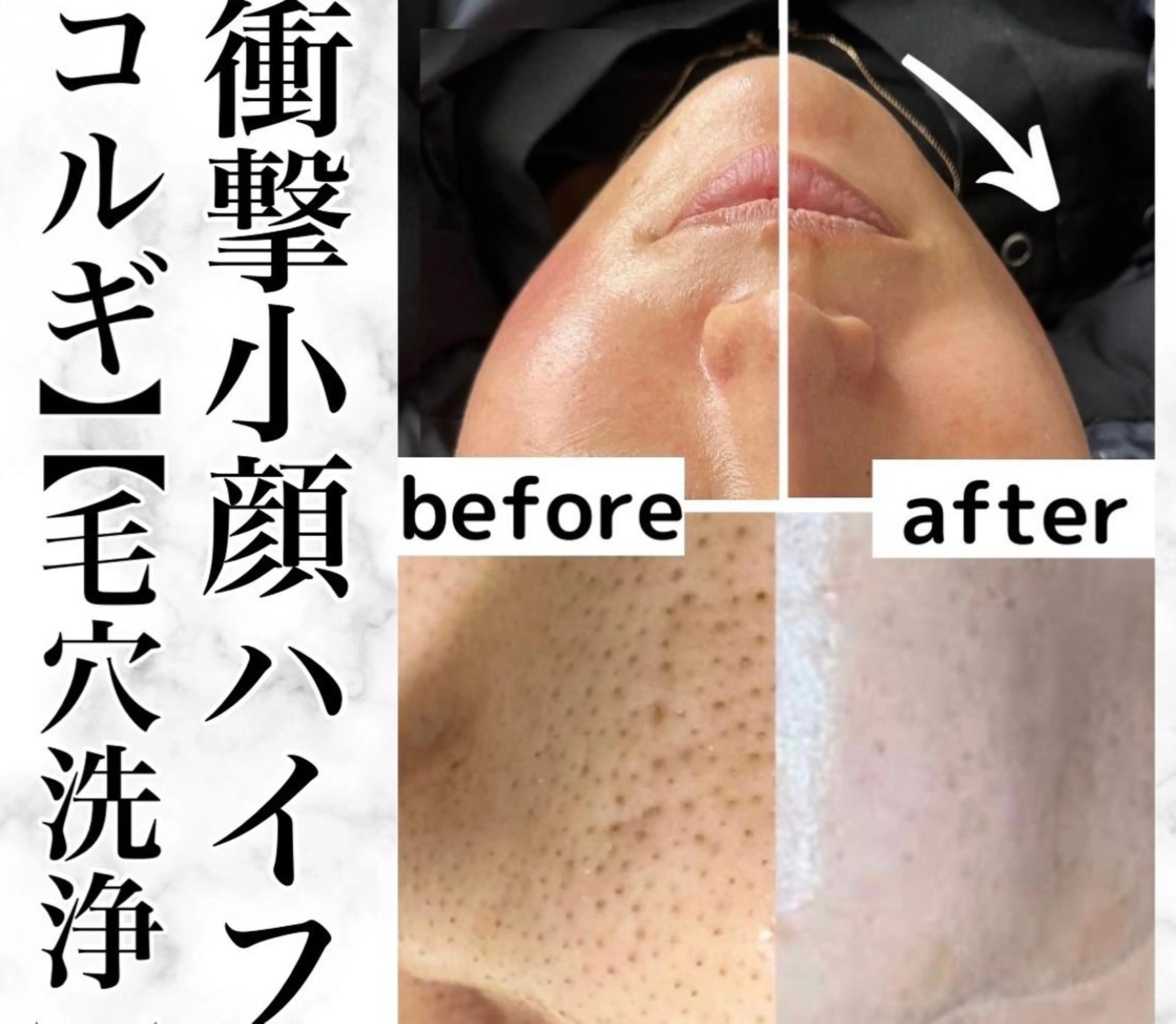 韓国系得意🦋 Aspire.のマツエク・マツパデザイン