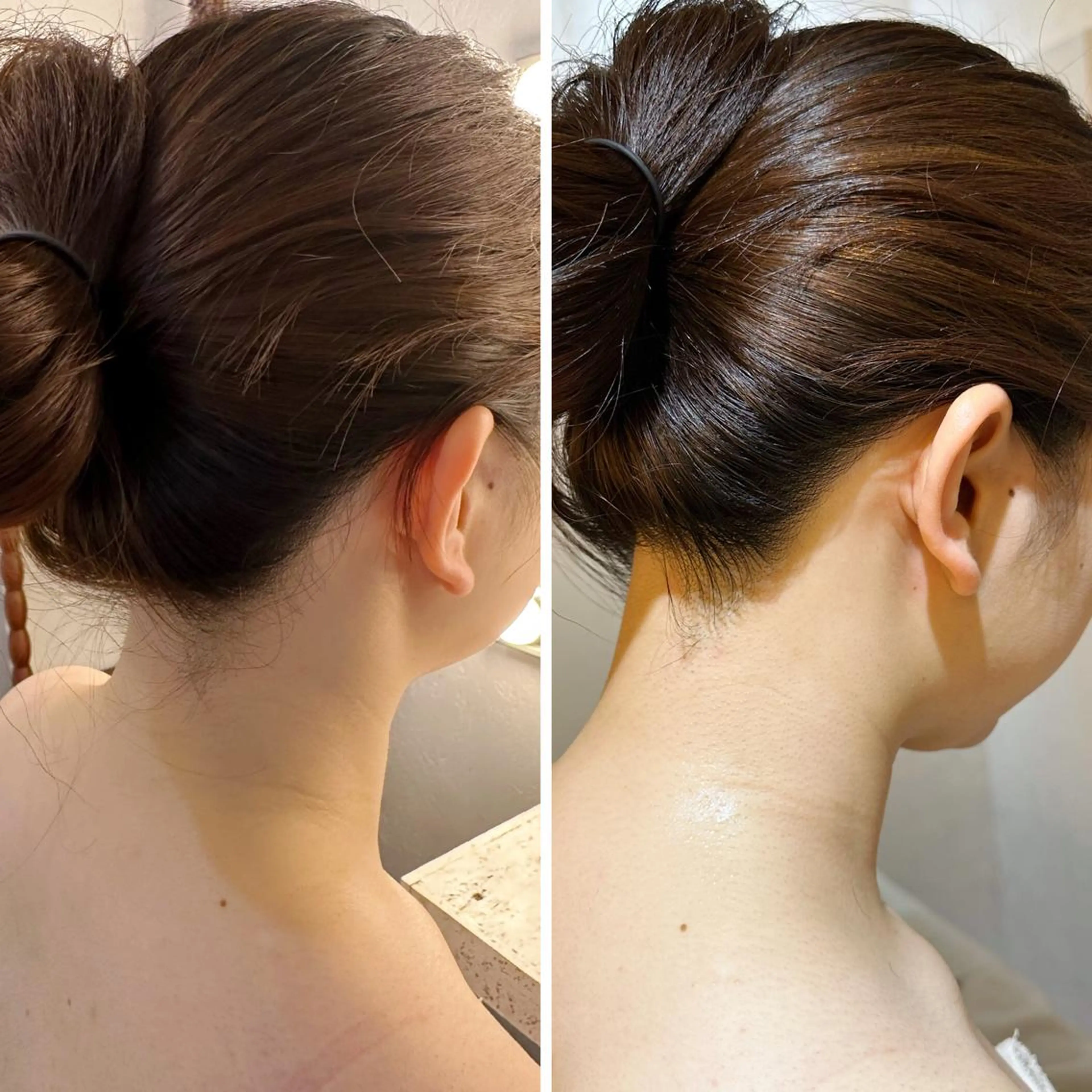 脱毛 うなじ脱毛/美肌脱毛 LABELのエステ・リラクイメージ