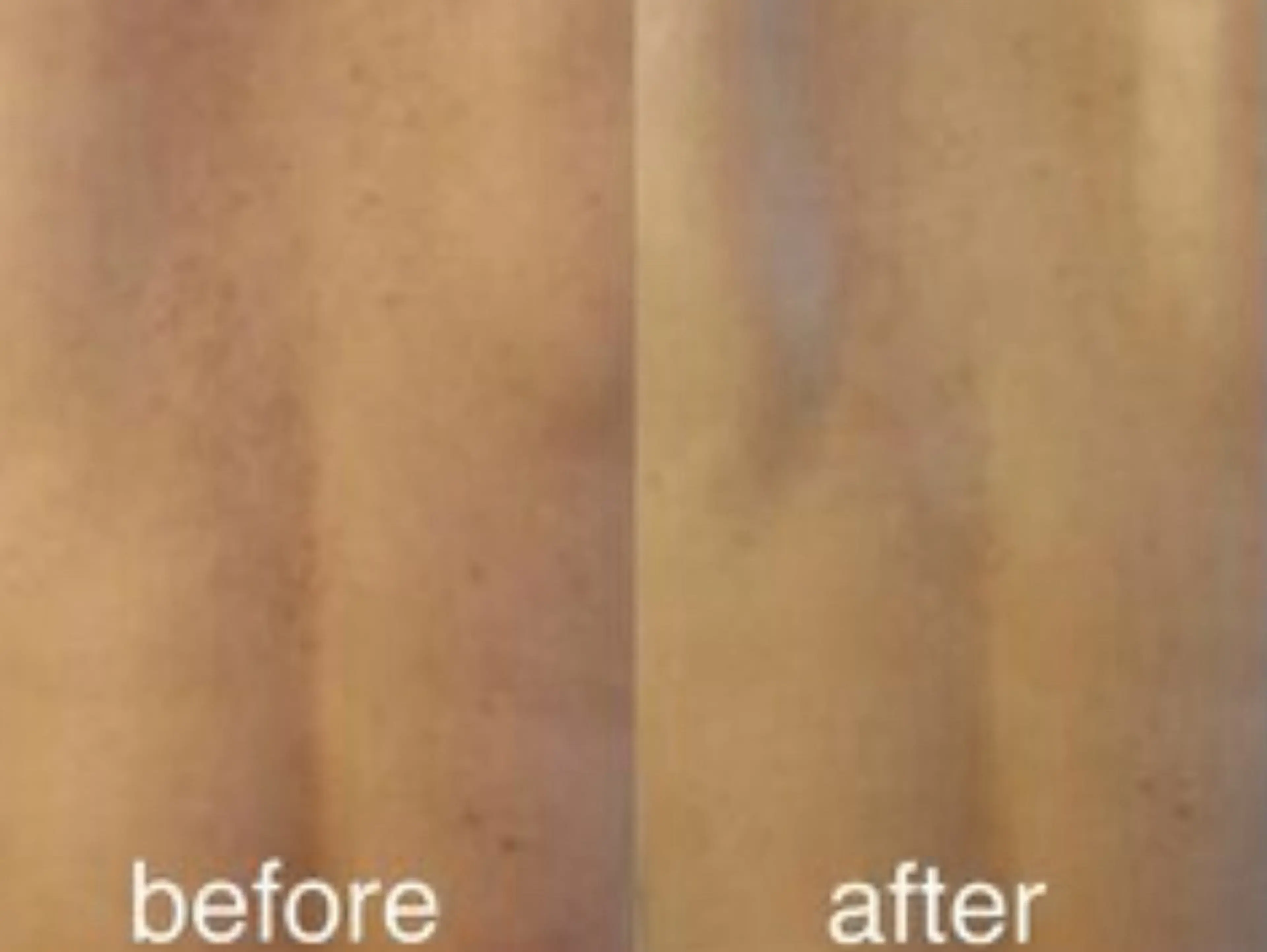 【背中毛穴/ニキビケア】ツルツルの背中orお尻REVIハーブピーリングの写真