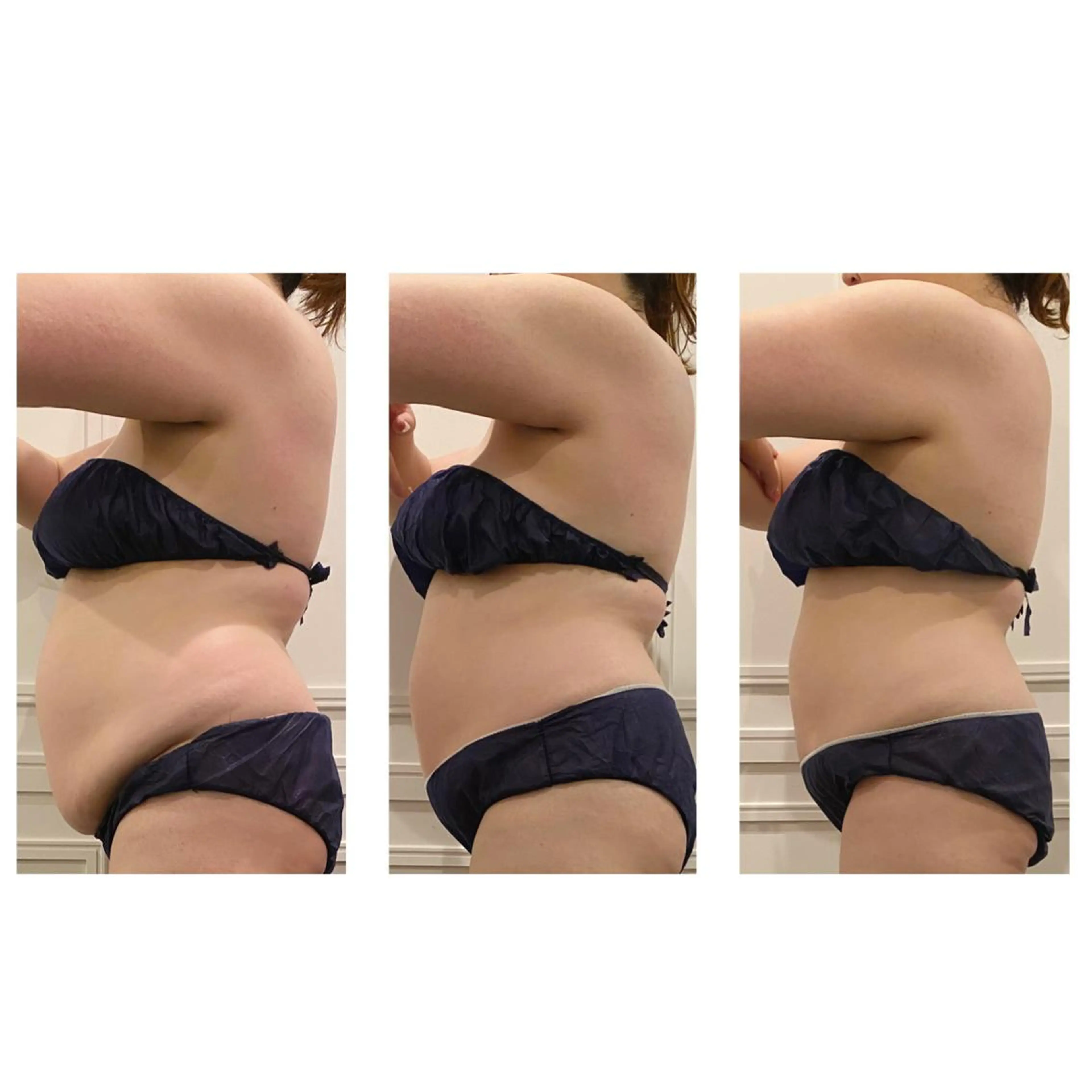 小顔EX心斎橋 REVIハーブのエステ・リラクイメージ