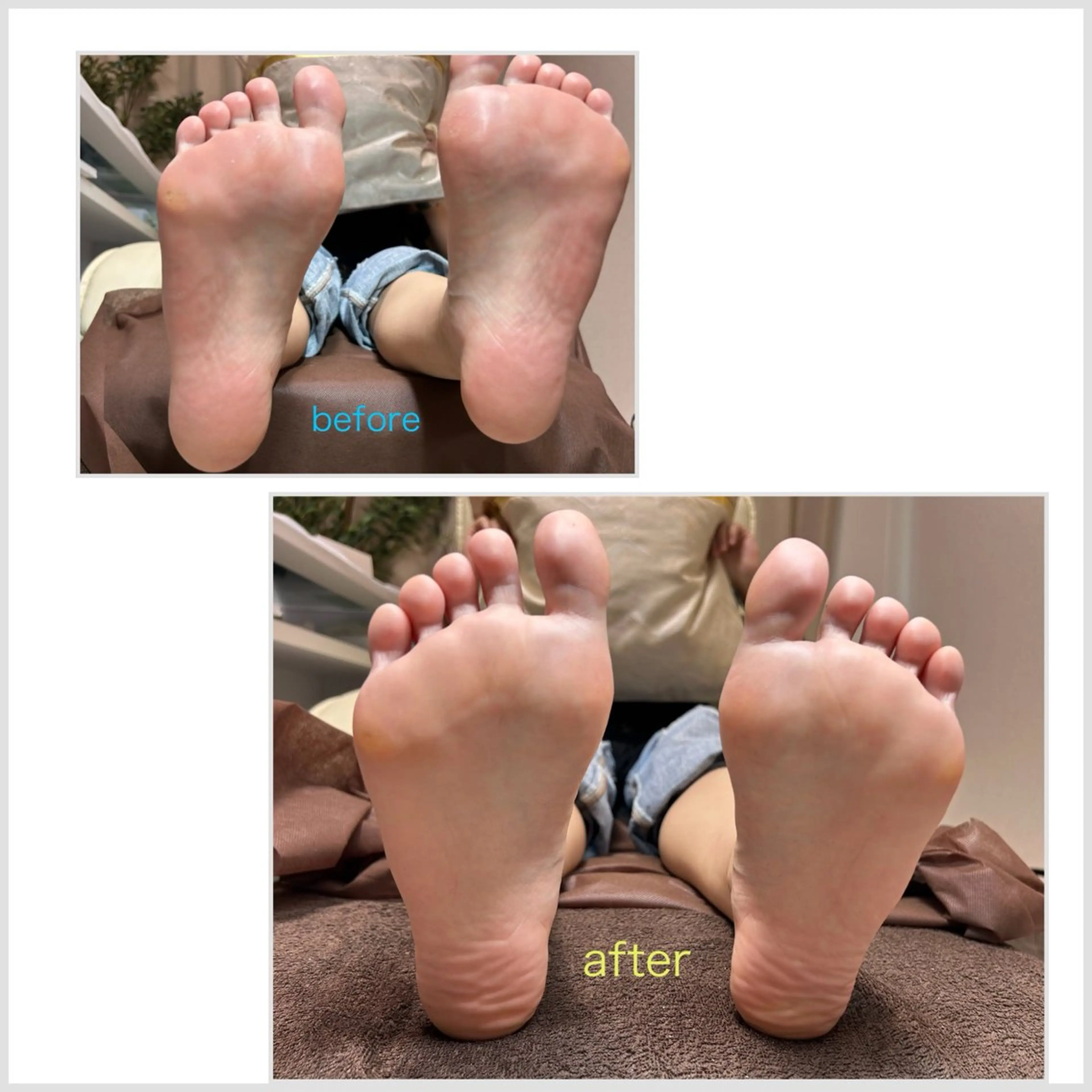 ◇  足裏 つるつるケア🌟の写真