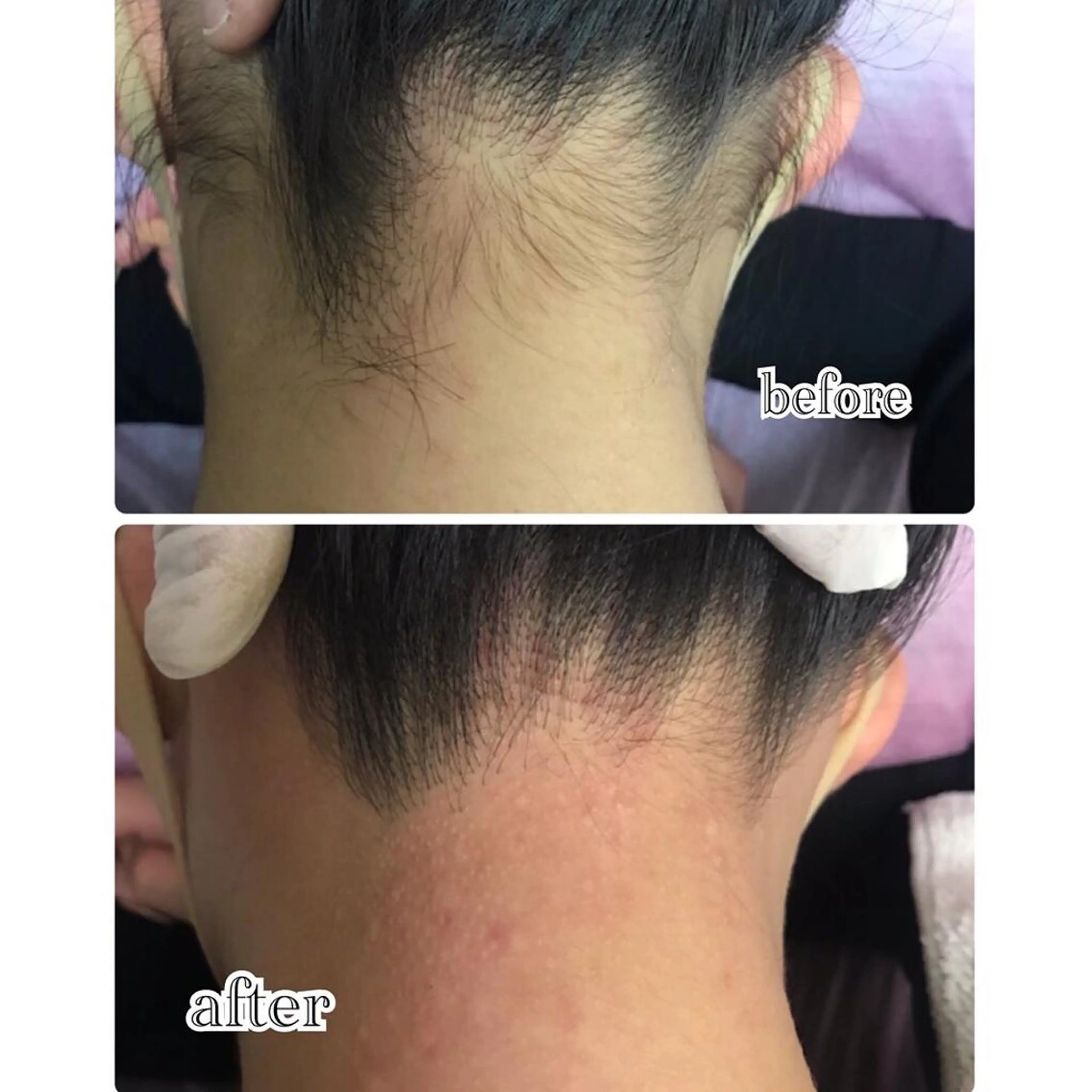 脱毛 MAKANA waxing&relaxation所属・MAKANA 吉岡 小岩店のエステ・リラクイメージ