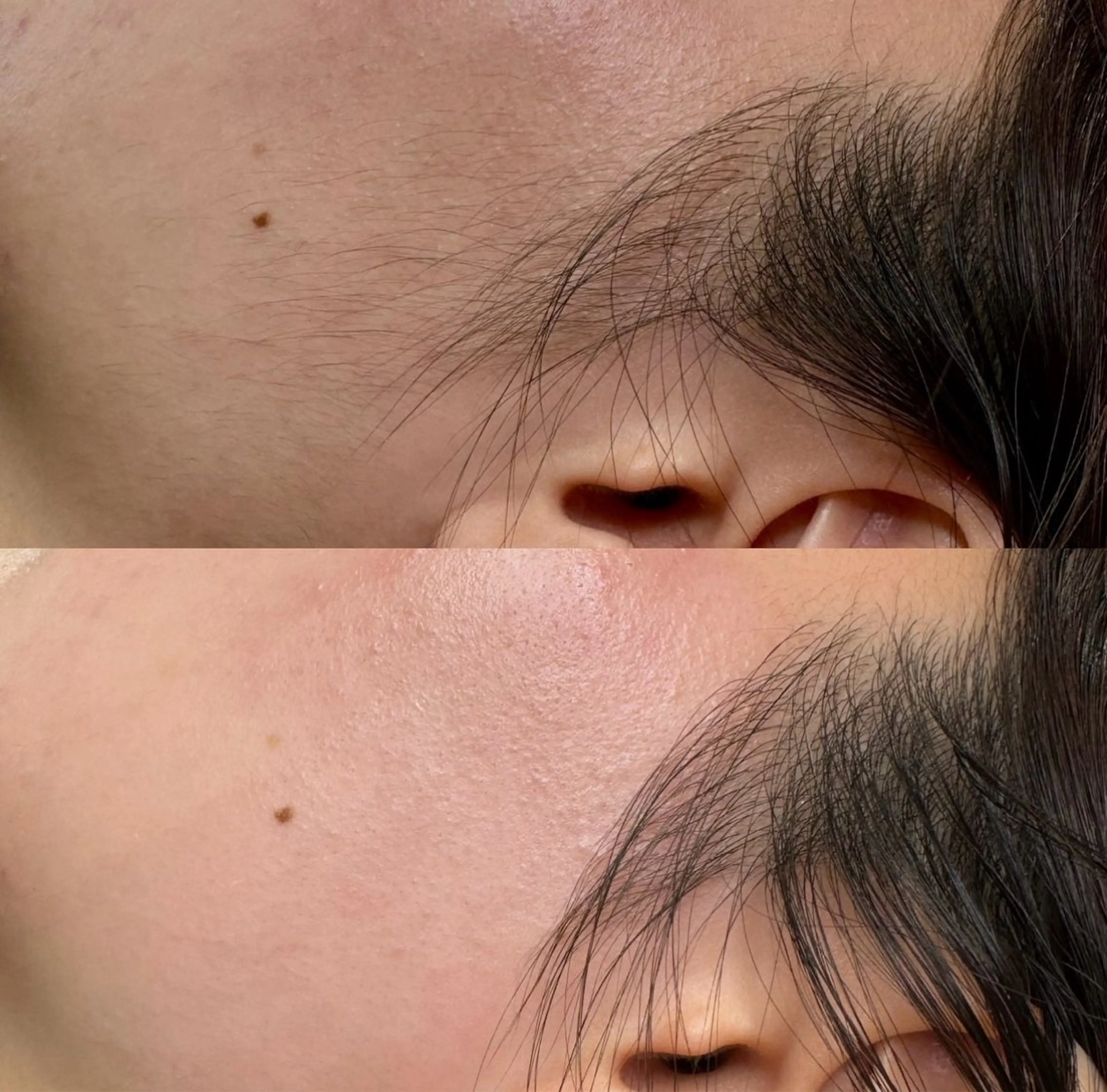 【モニター様募集】FACEWAX脱毛の写真