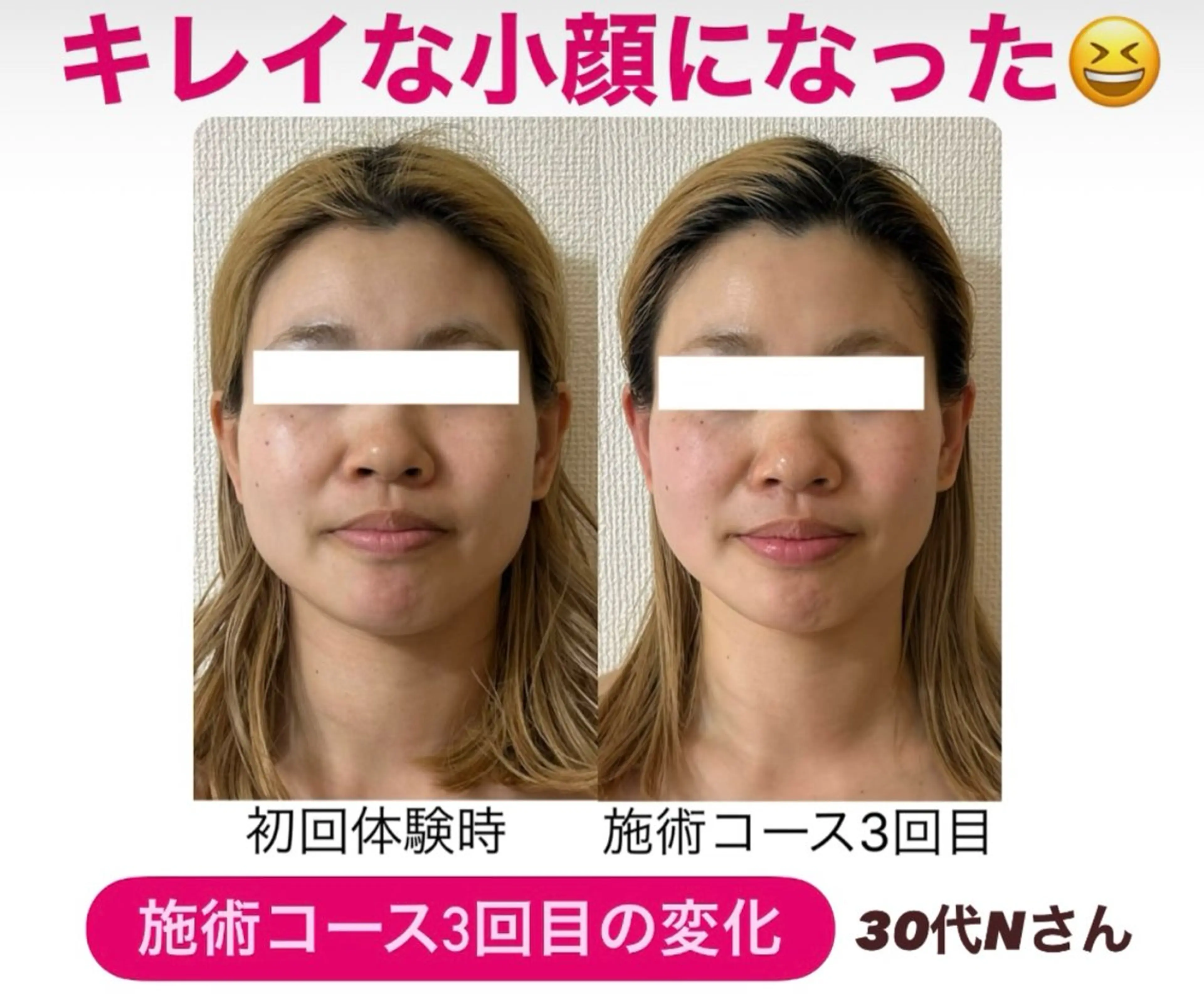 小顔サロン (ラ リュミエール)のエステ・リラクイメージ