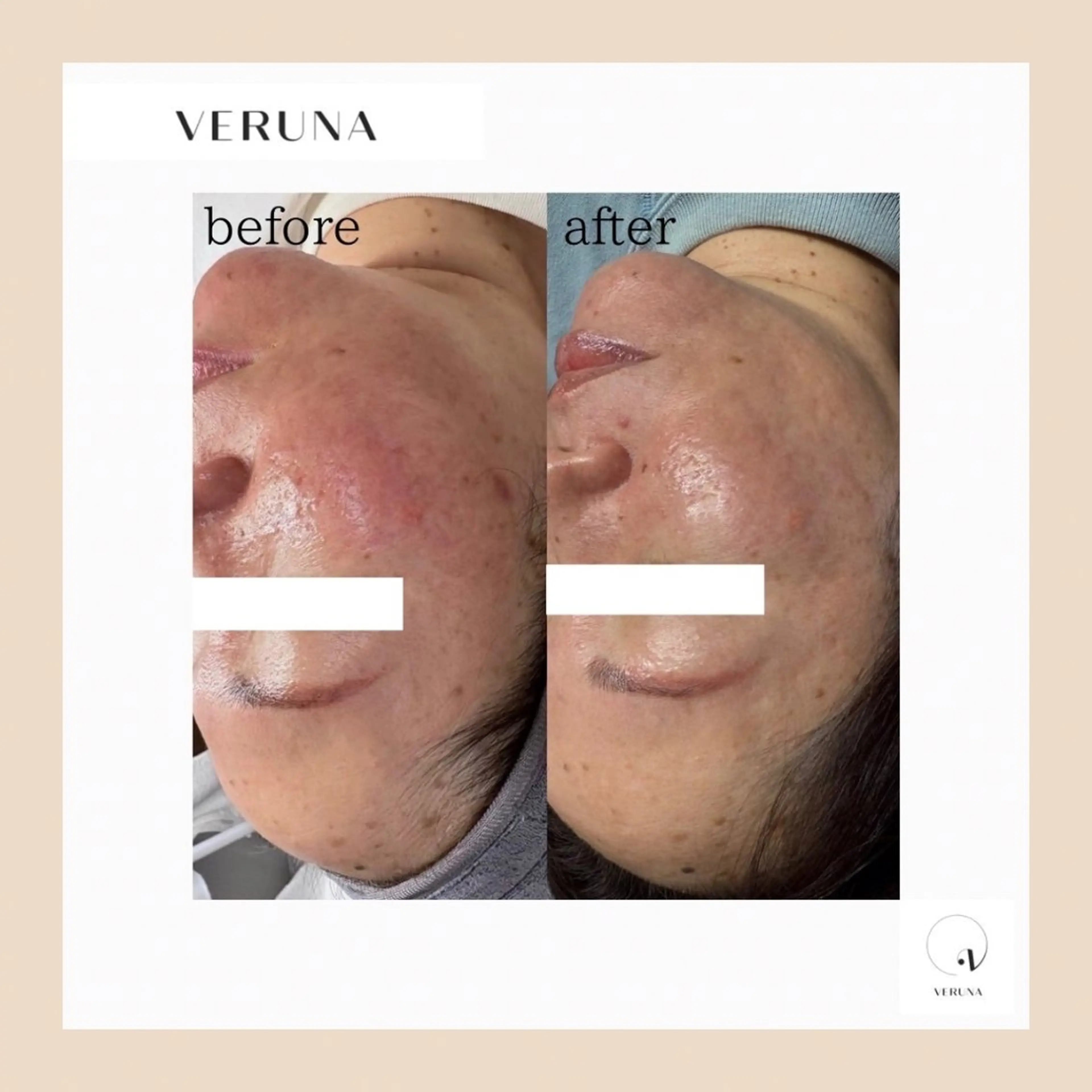 ピーリング専門店 Belluteのエステ・リラクイメージ