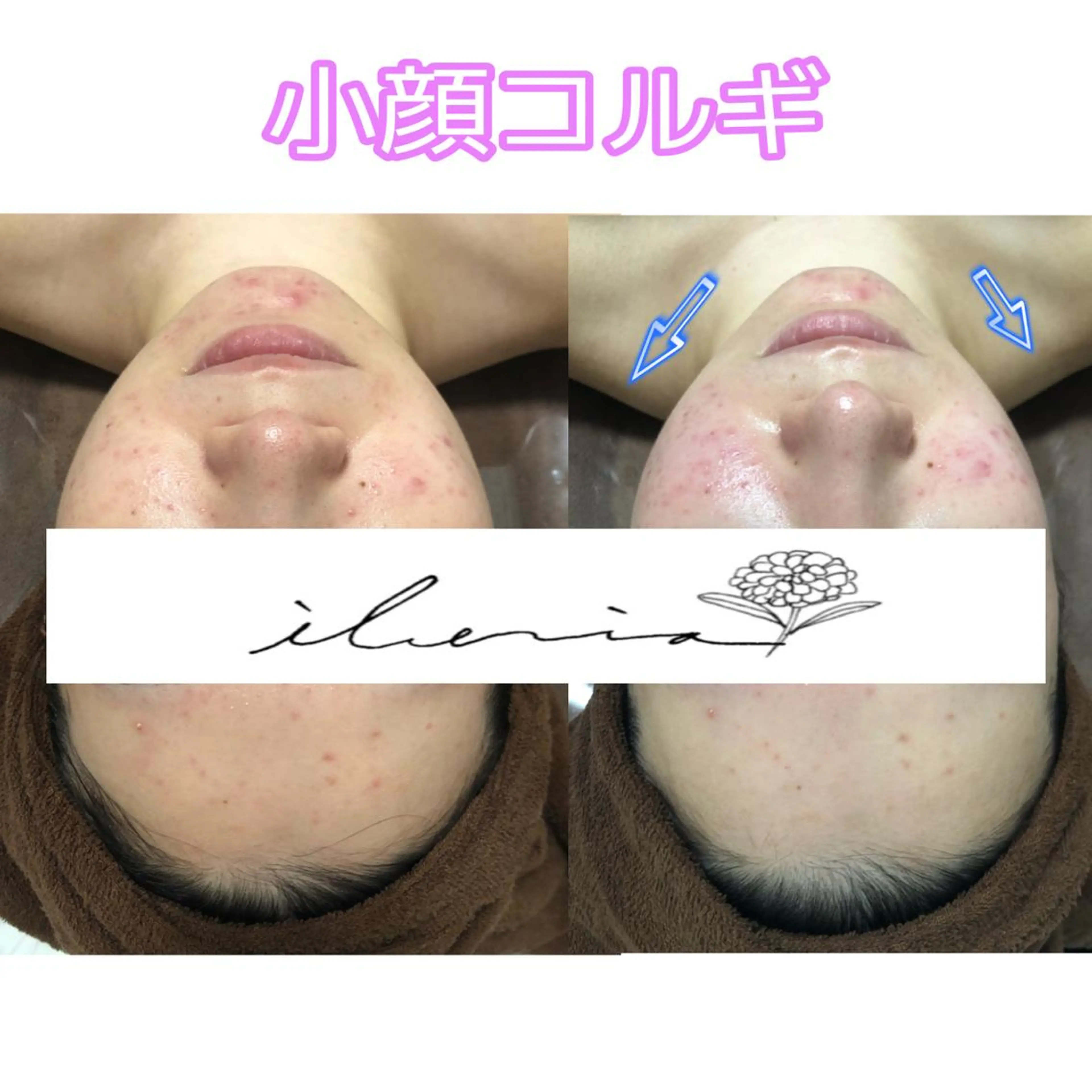 心斎橋痩身ダイエット 韓国.美容鍼.小顔のエステ・リラクイメージ