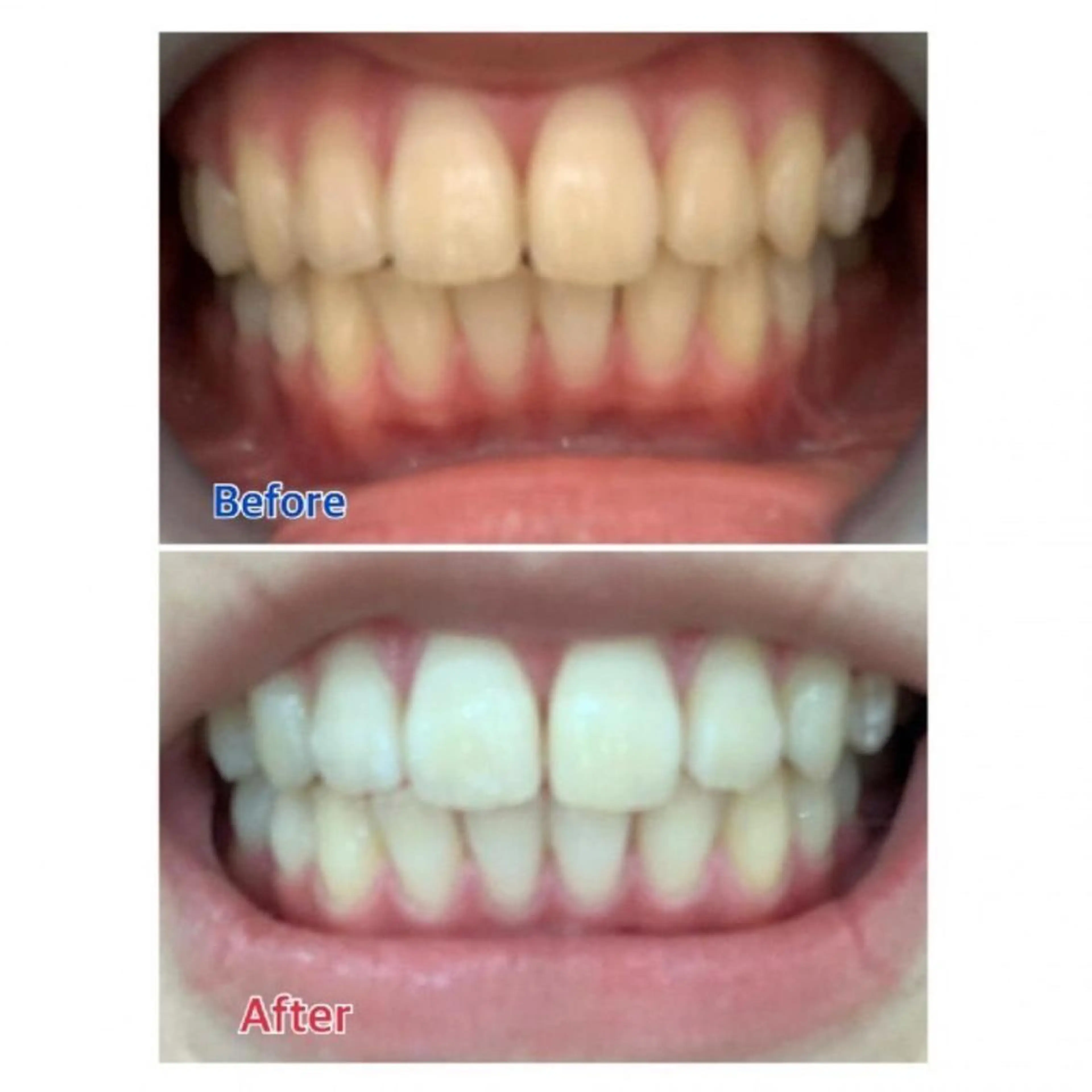 M渋谷 ホワイトニングのエステ・リラクイメージ