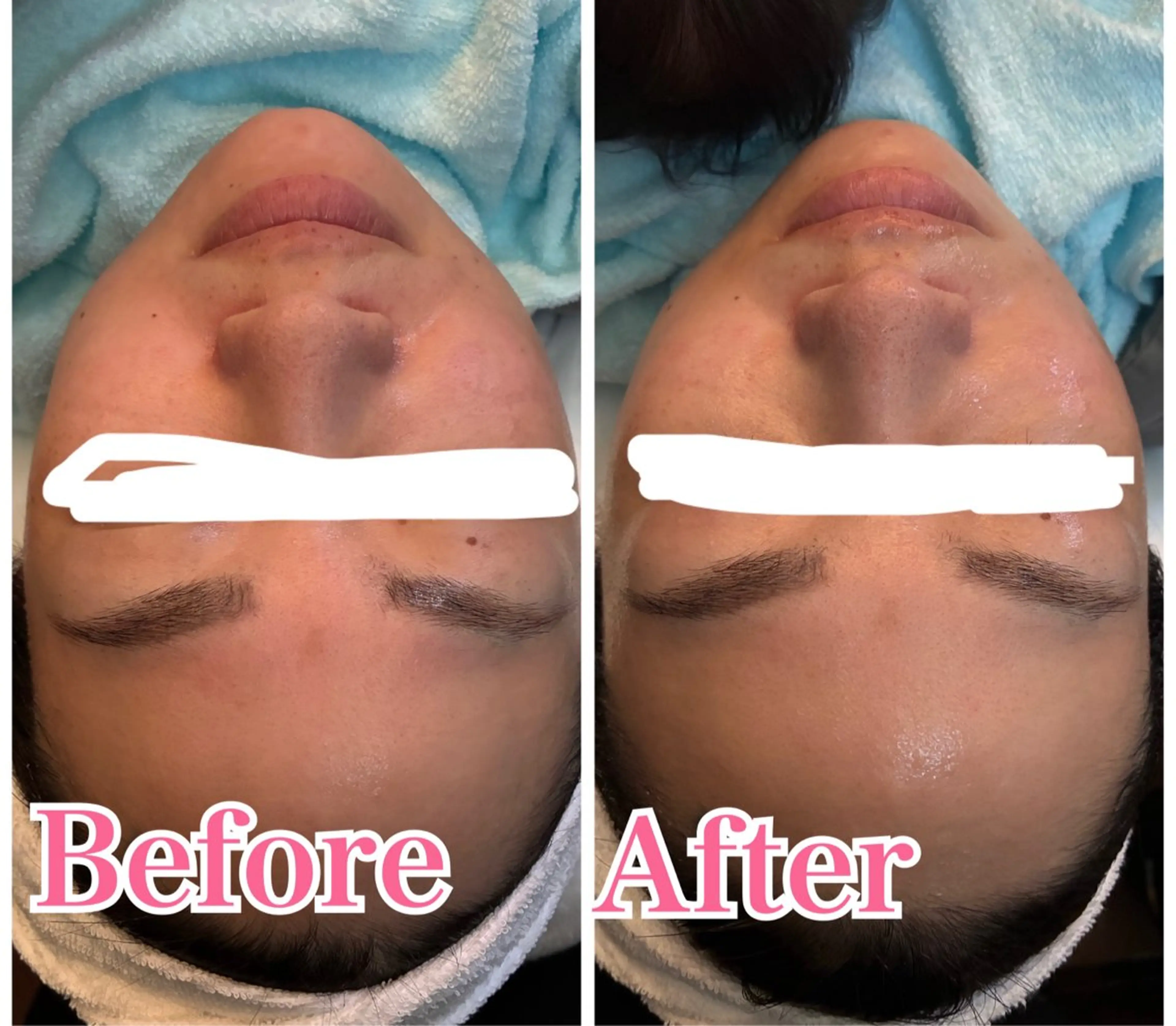 エステ 久留本 茜のエステ・リラクイメージ