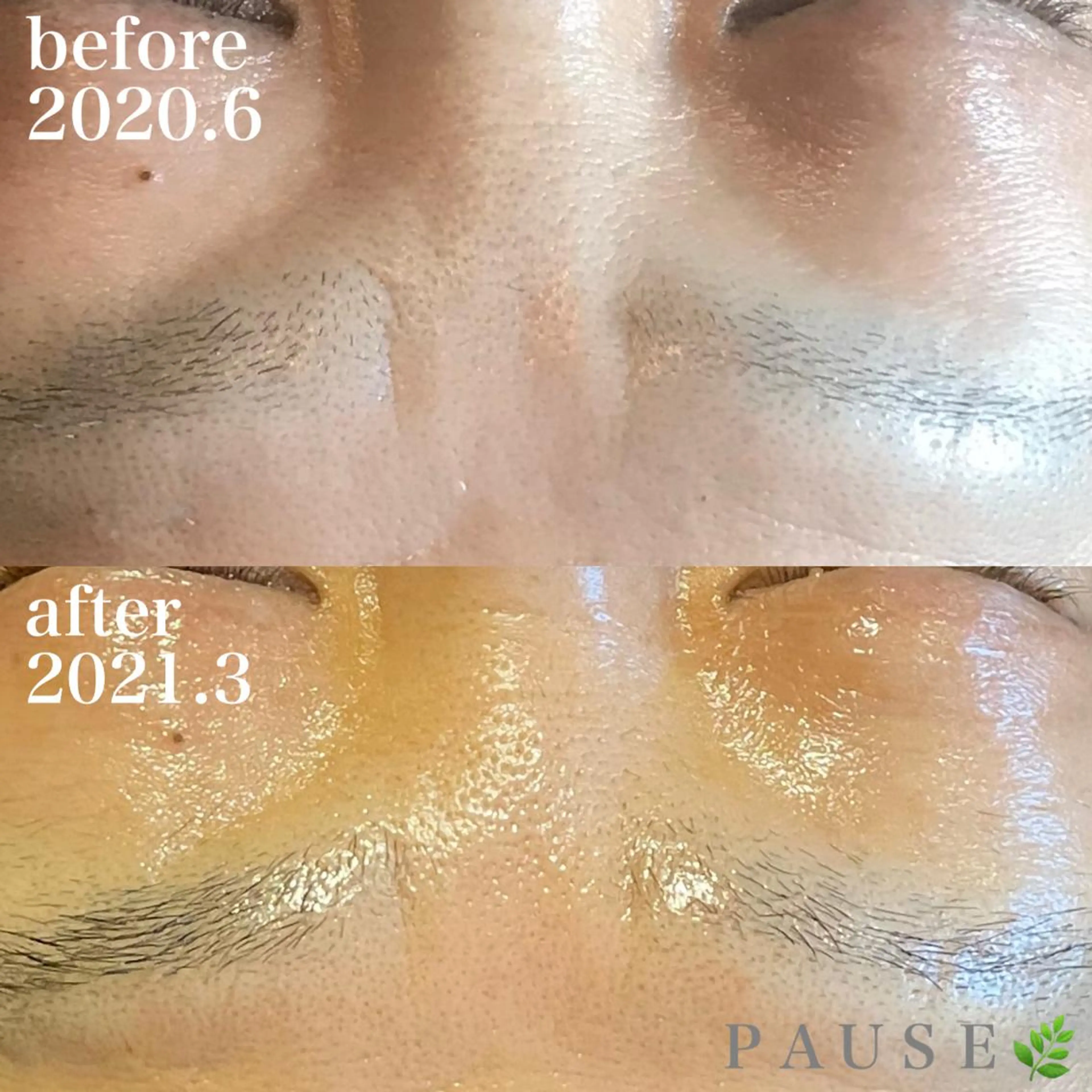 エステ 浜野 恵美のエステ・リラクイメージ