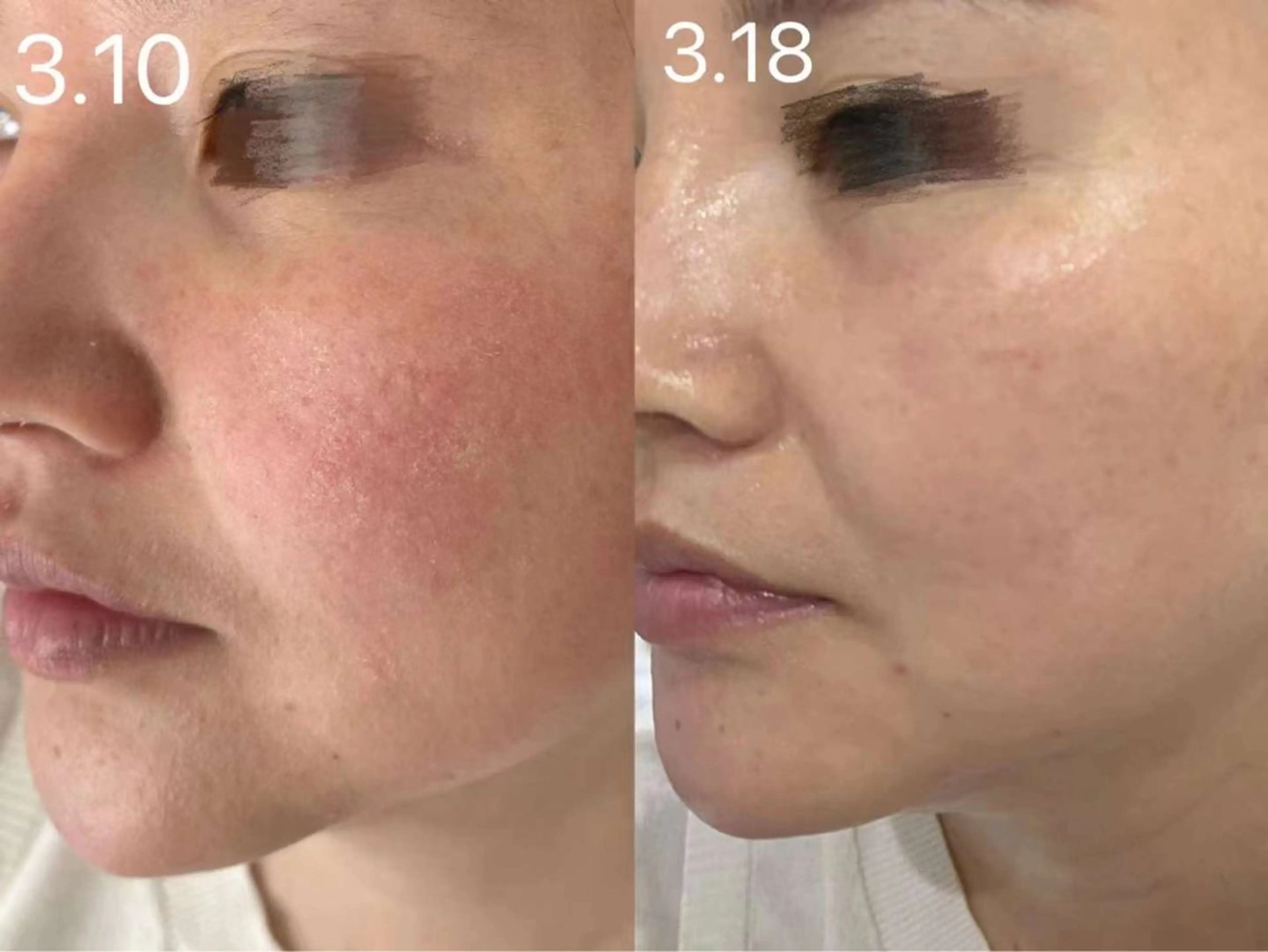 ネイル エステ aliaハーブ水光店 エステティシャン募集のエステ・リラクイメージ