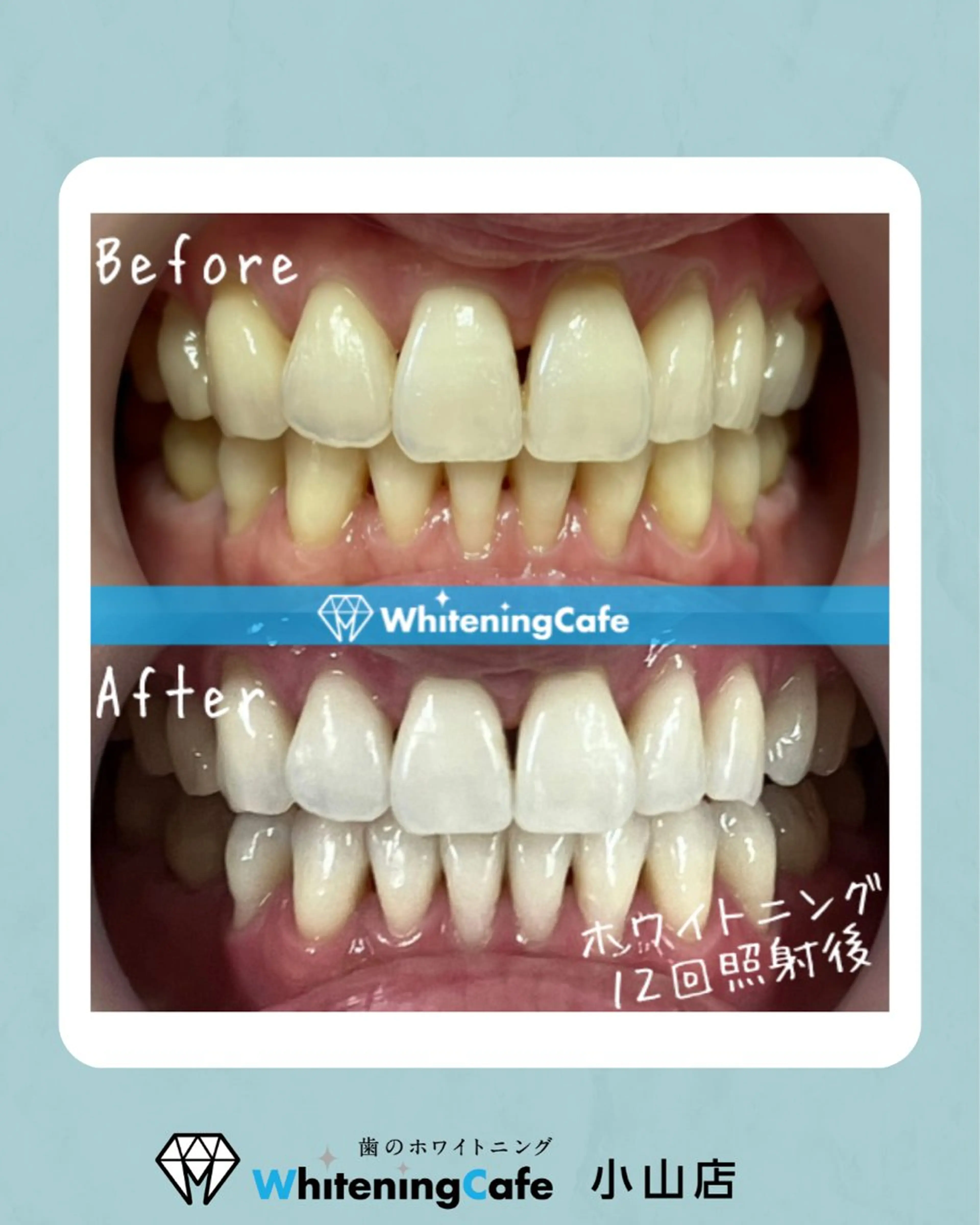 ホワイトニングカフェ 小山店のエステ・リラクイメージ