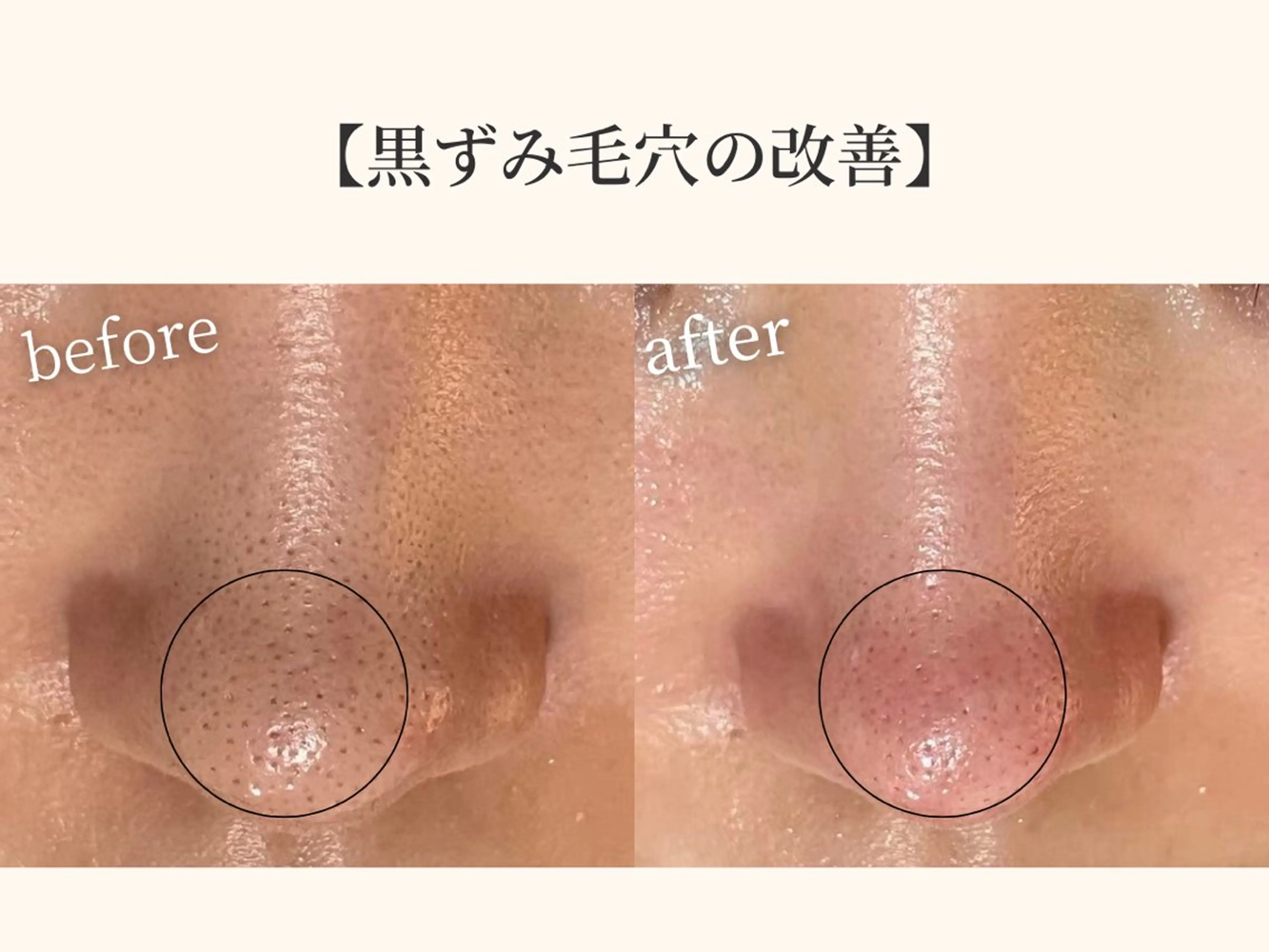 小顔矯正×毛穴サロン DRRAMSPA町田のエステ・リラクイメージ