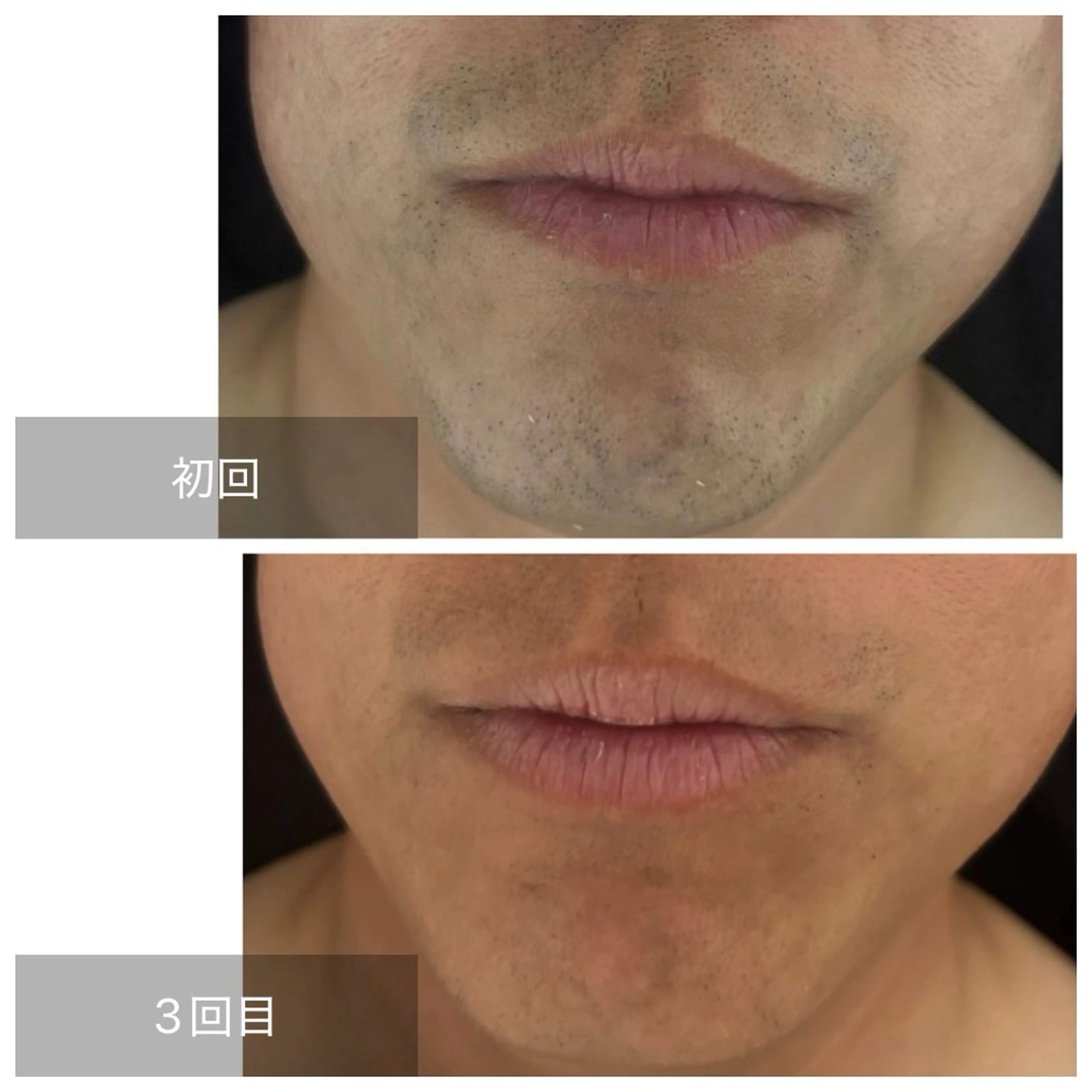 メンズ エマニエル USAのエステ・リラクイメージ