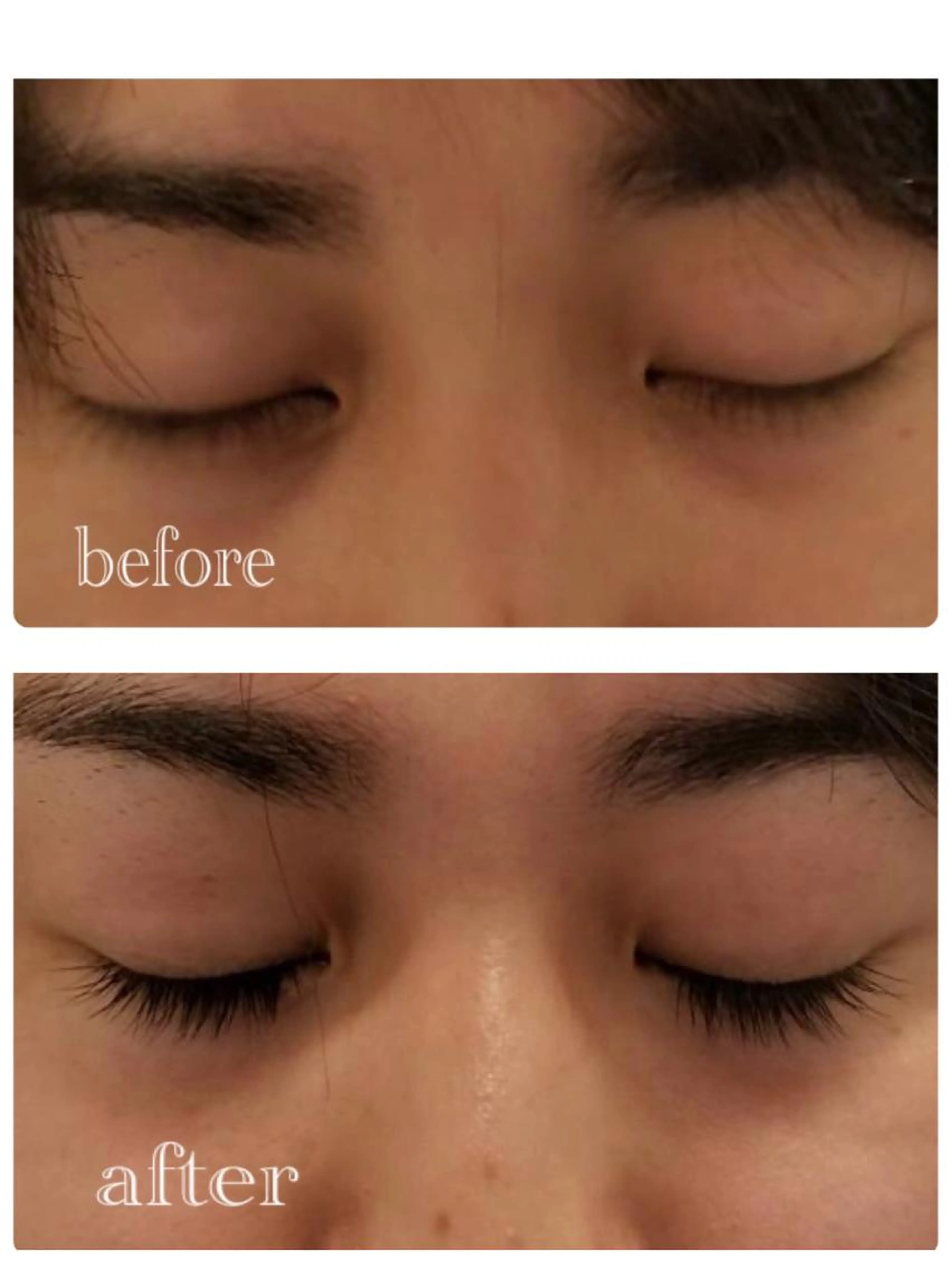 掲載激レア！即日限定SNSモデル《メンズまつ毛エクステ》80本トリートメント付きの写真