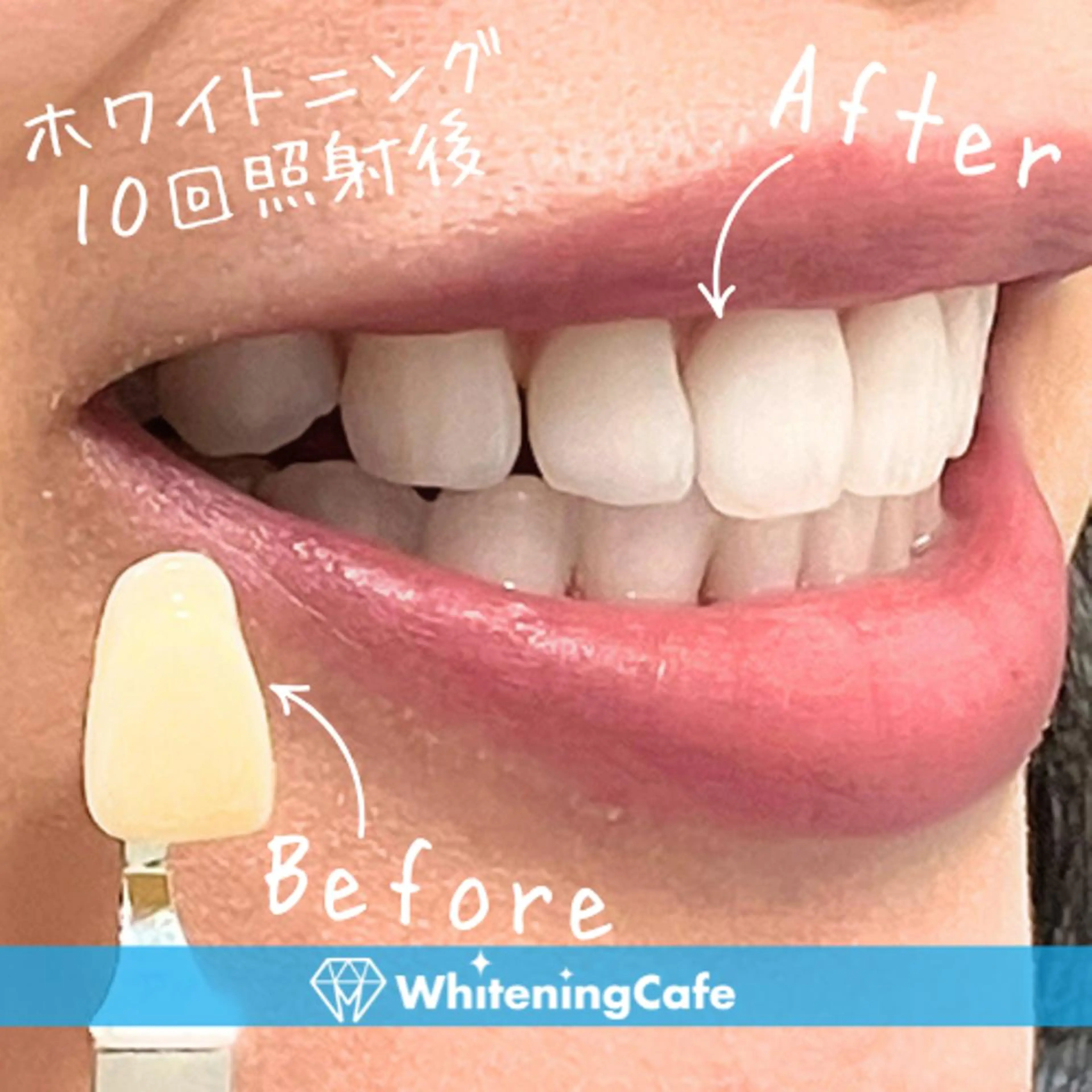 メンズ エステ リラク ホワイトニング カフェ川越店のエステ・リラクイメージ