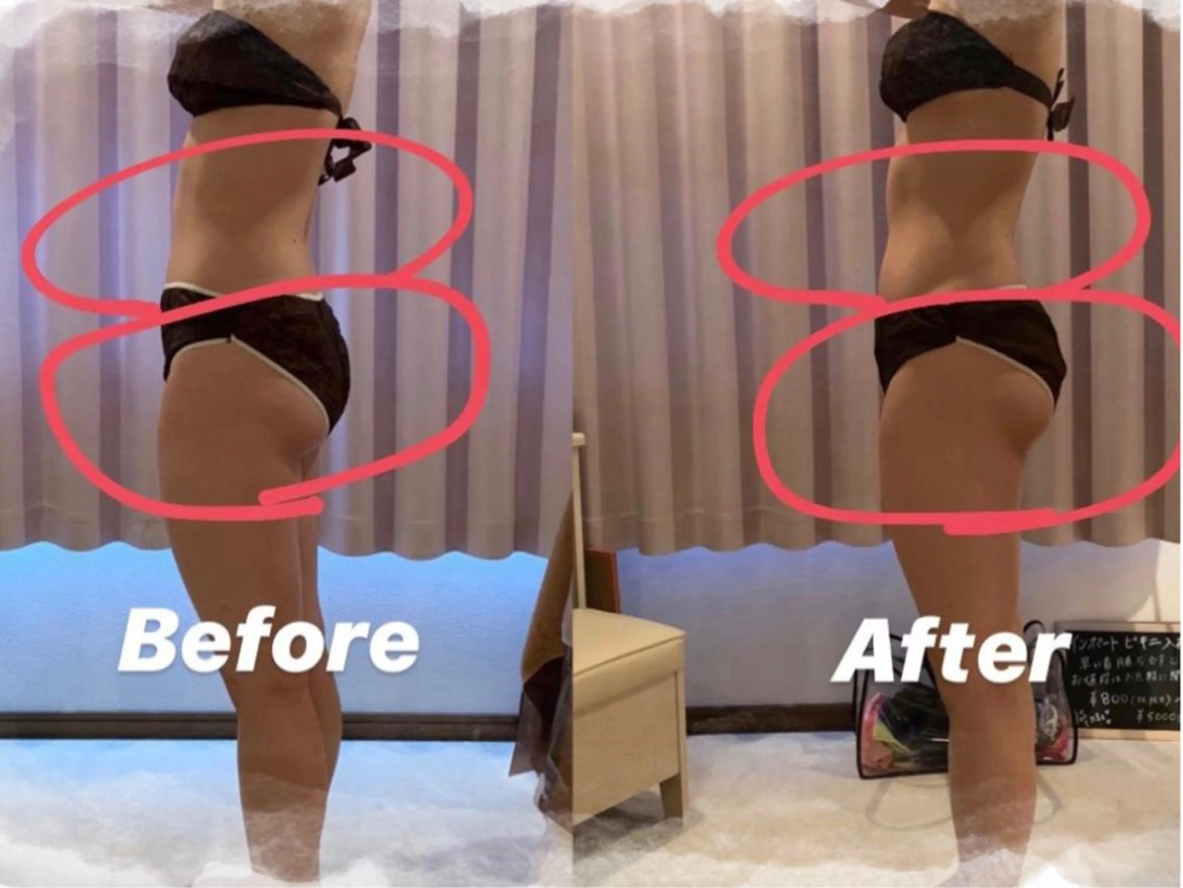 ワックス脱毛 ♡AYO♡のエステ・リラクイメージ