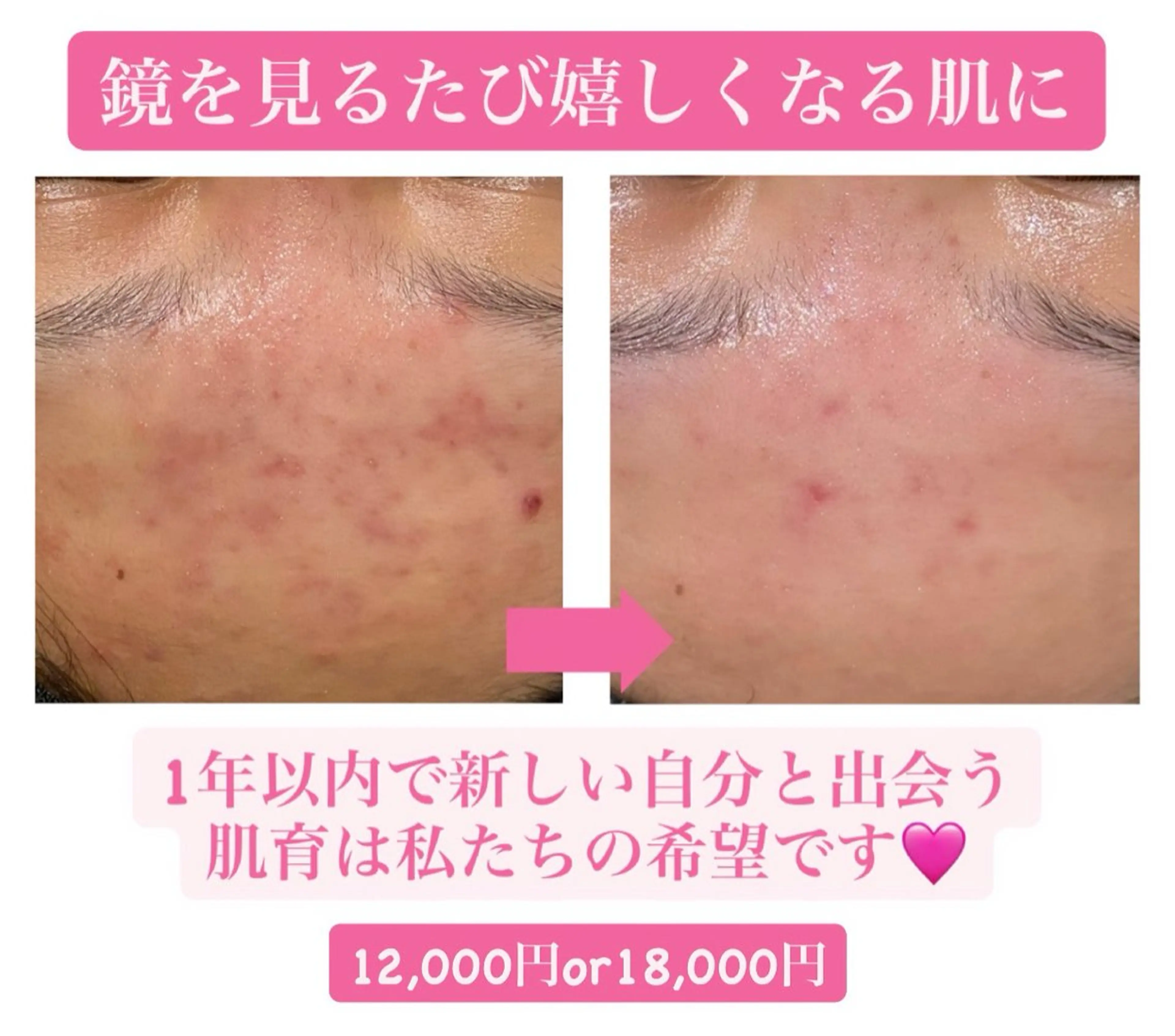 エステ 太田 女久美のエステ・リラクイメージ