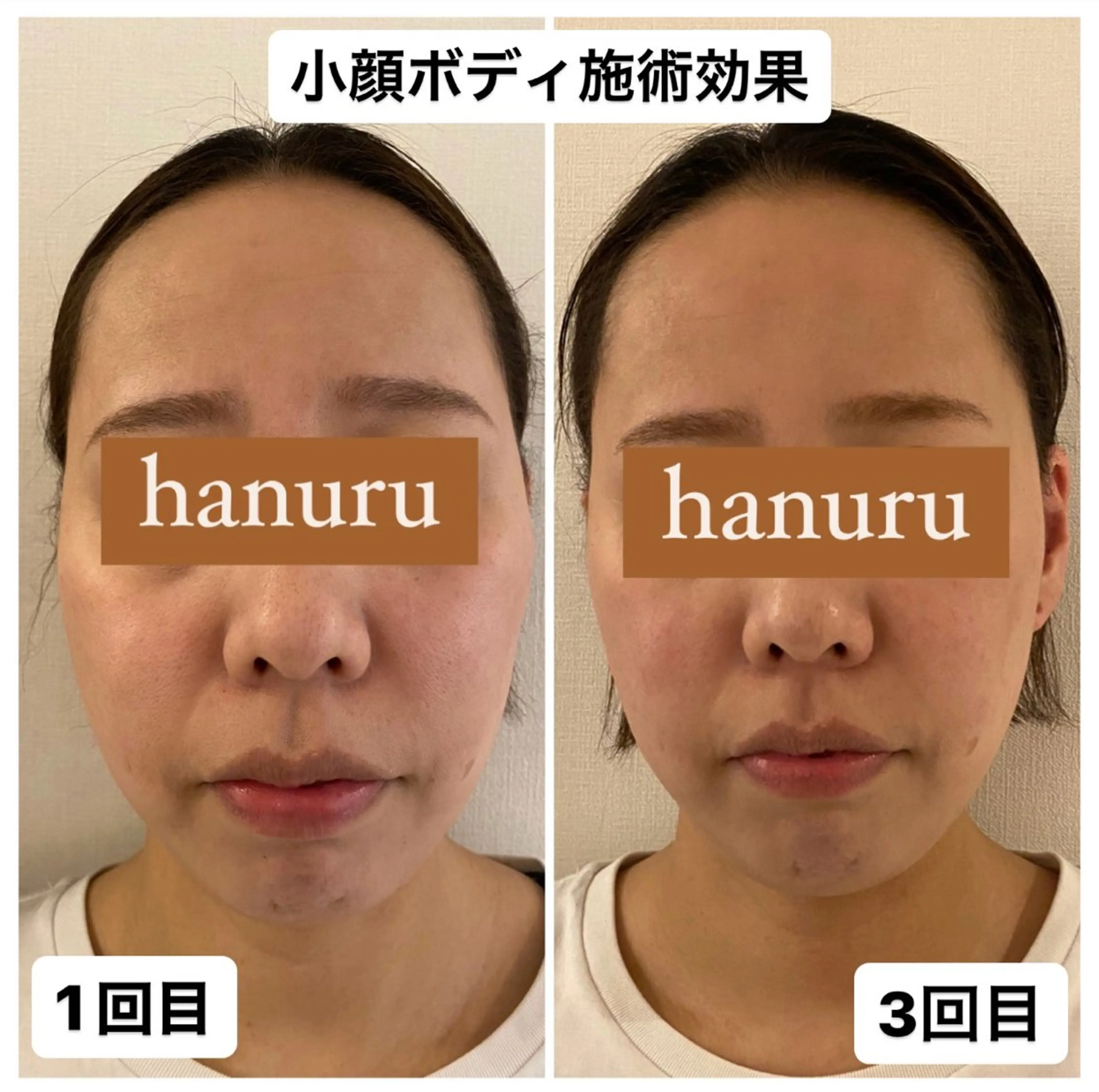 美容整体・小顔矯正 hanuruのエステ・リラクイメージ
