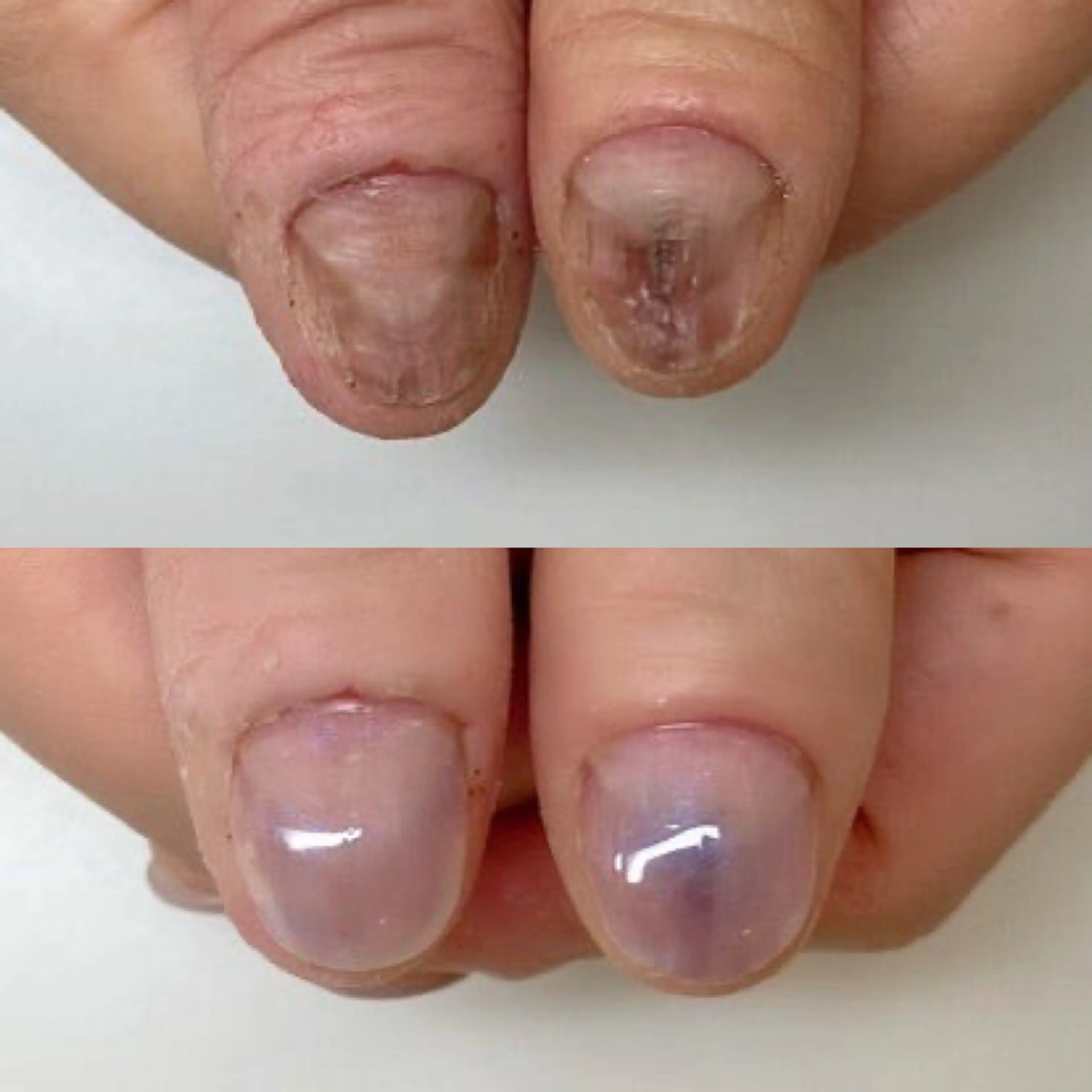 ネイル ネイルサロン アリュームのネイルデザイン