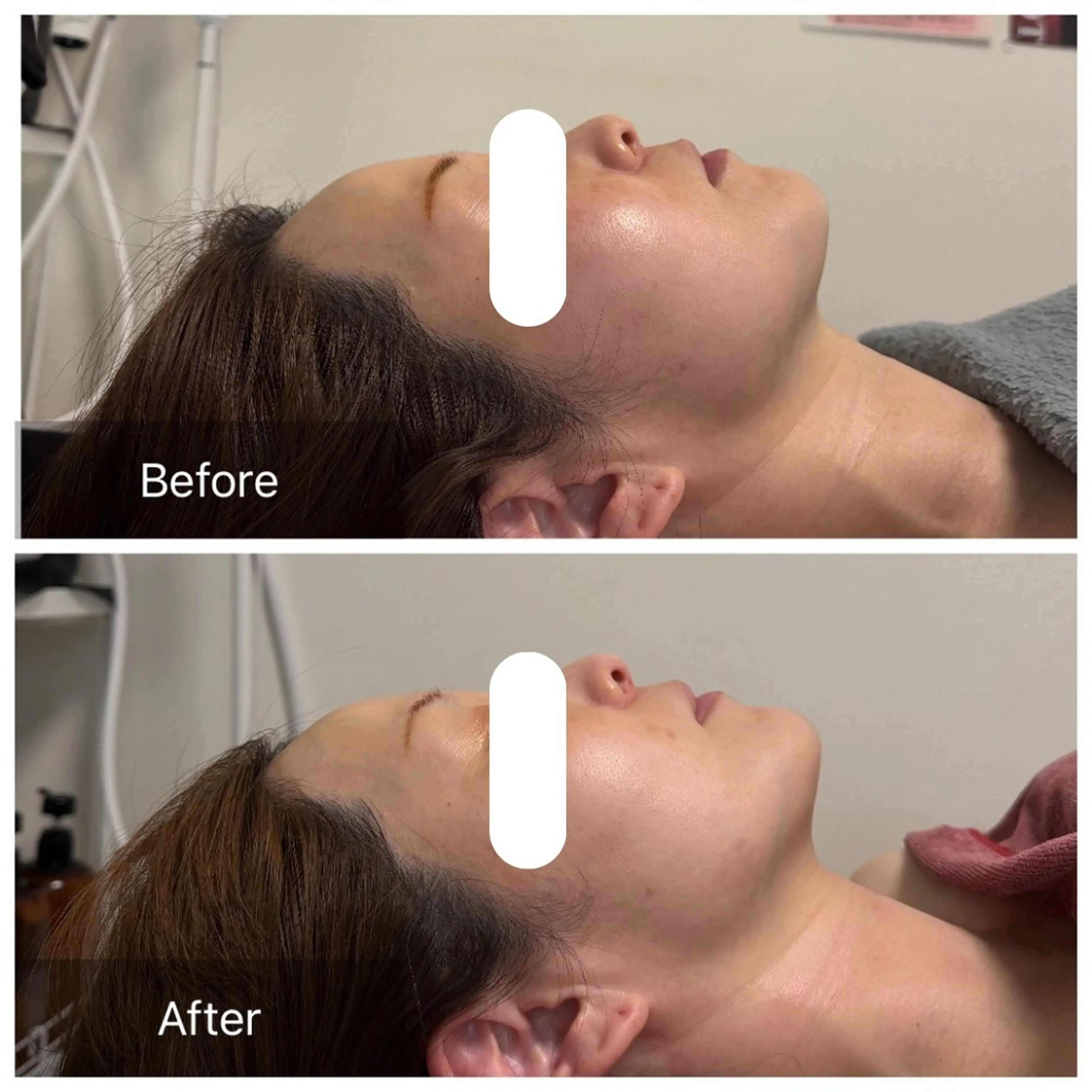 エステ リラク 池田 桃花のエステ・リラクイメージ