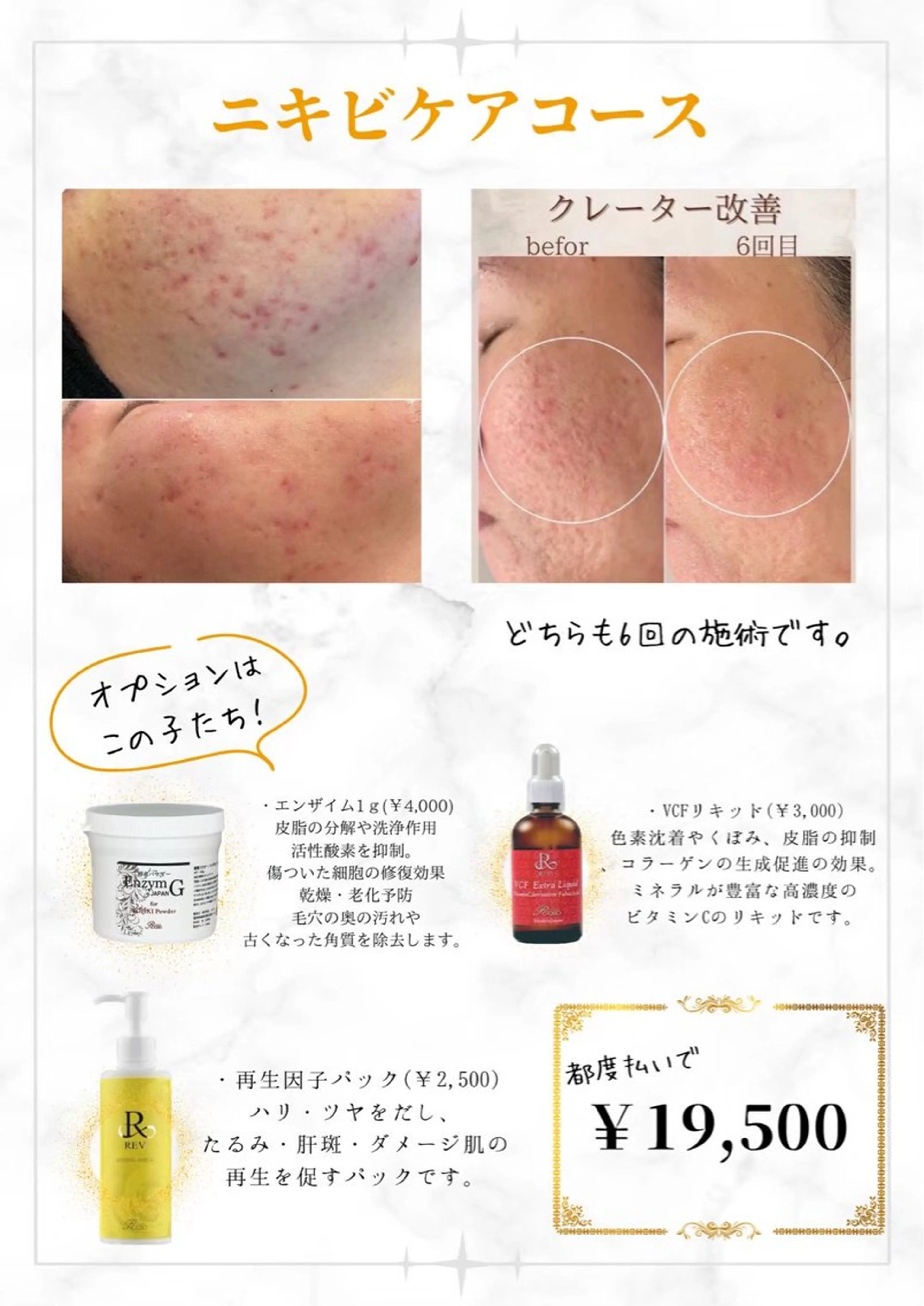 ハーブピーリング🌿ニキビにお悩みの方✨の写真