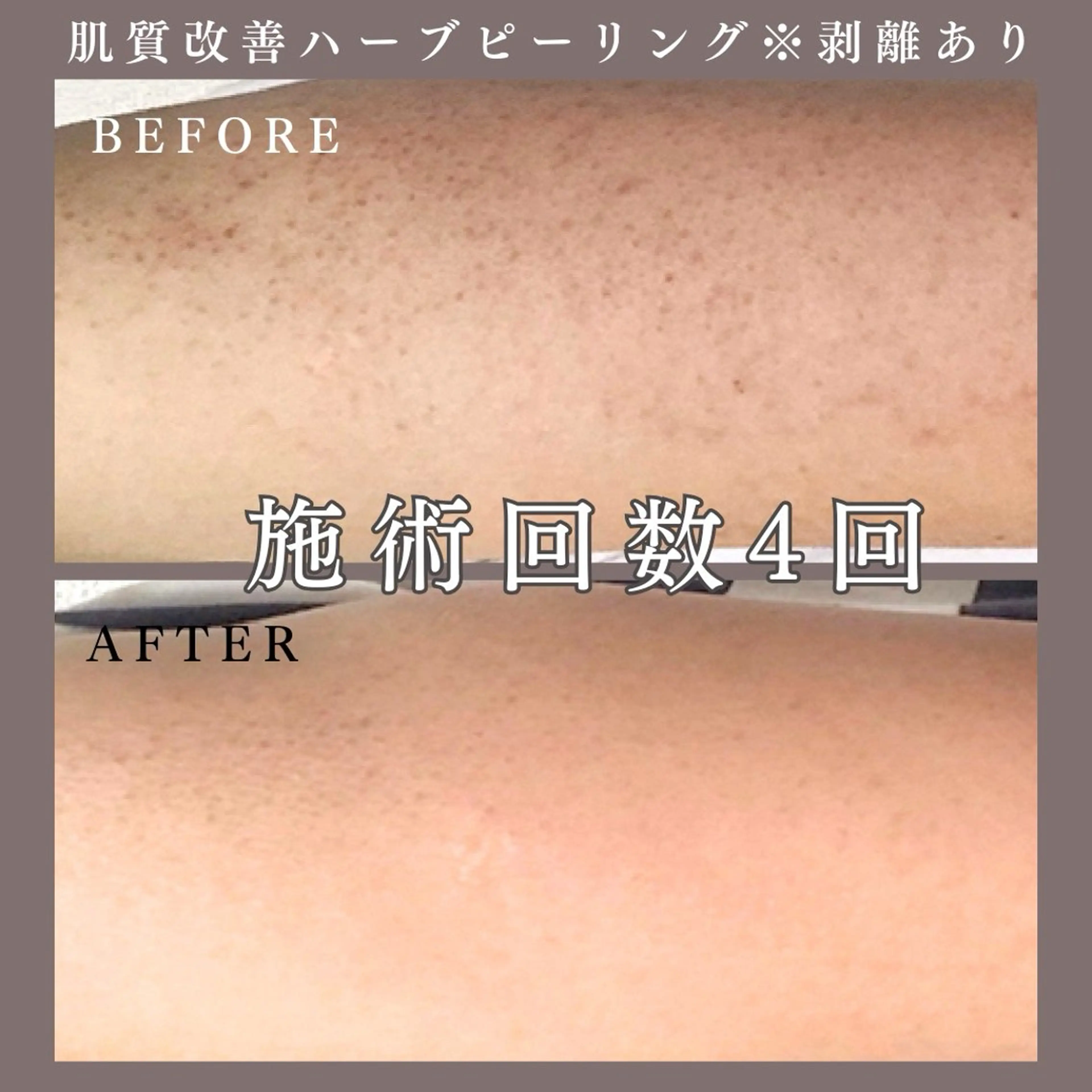 肌質改善専門サロン Bellmi/心斎橋のエステ・リラクイメージ