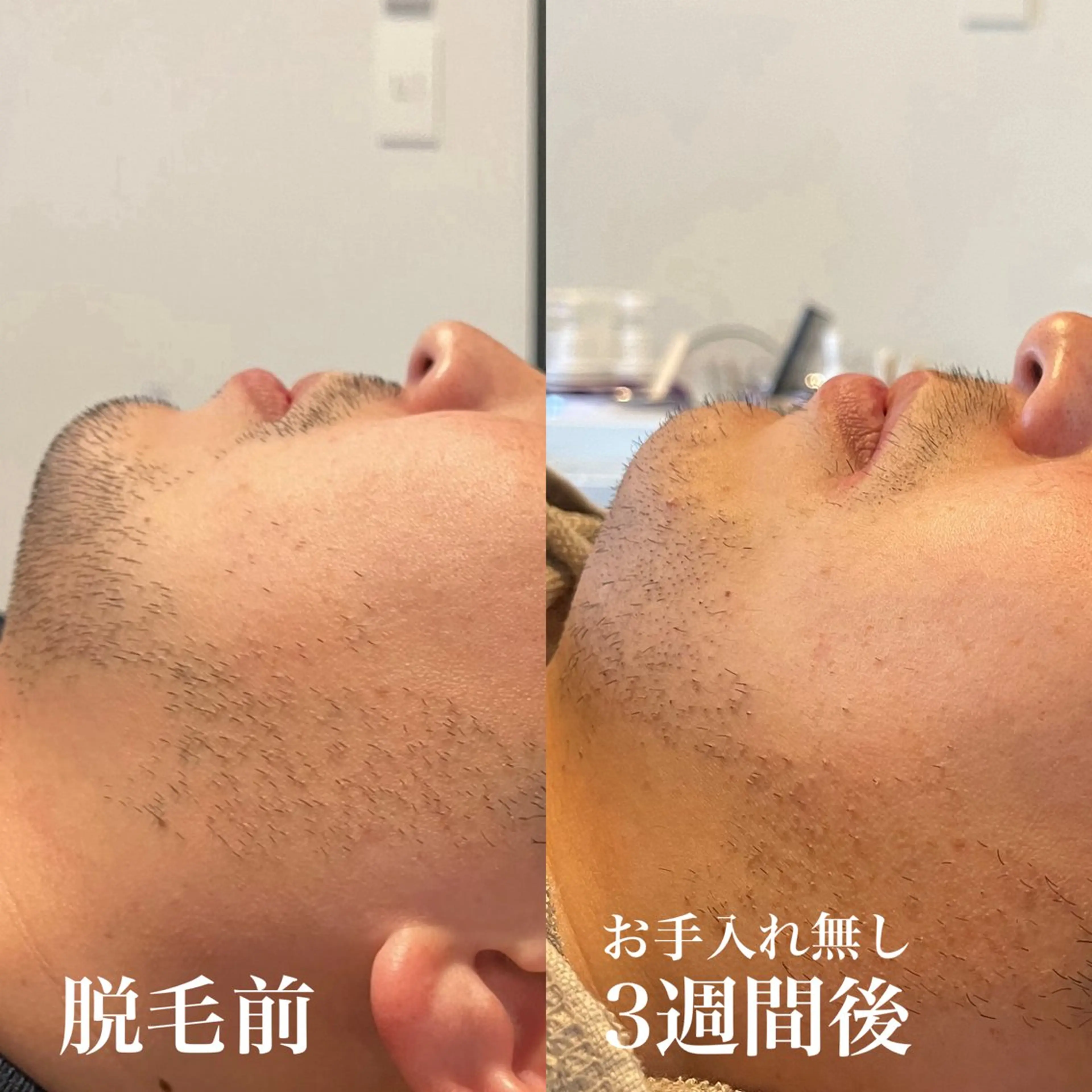 メンズ wax脱毛専門店 ハイラントのエステ・リラクイメージ