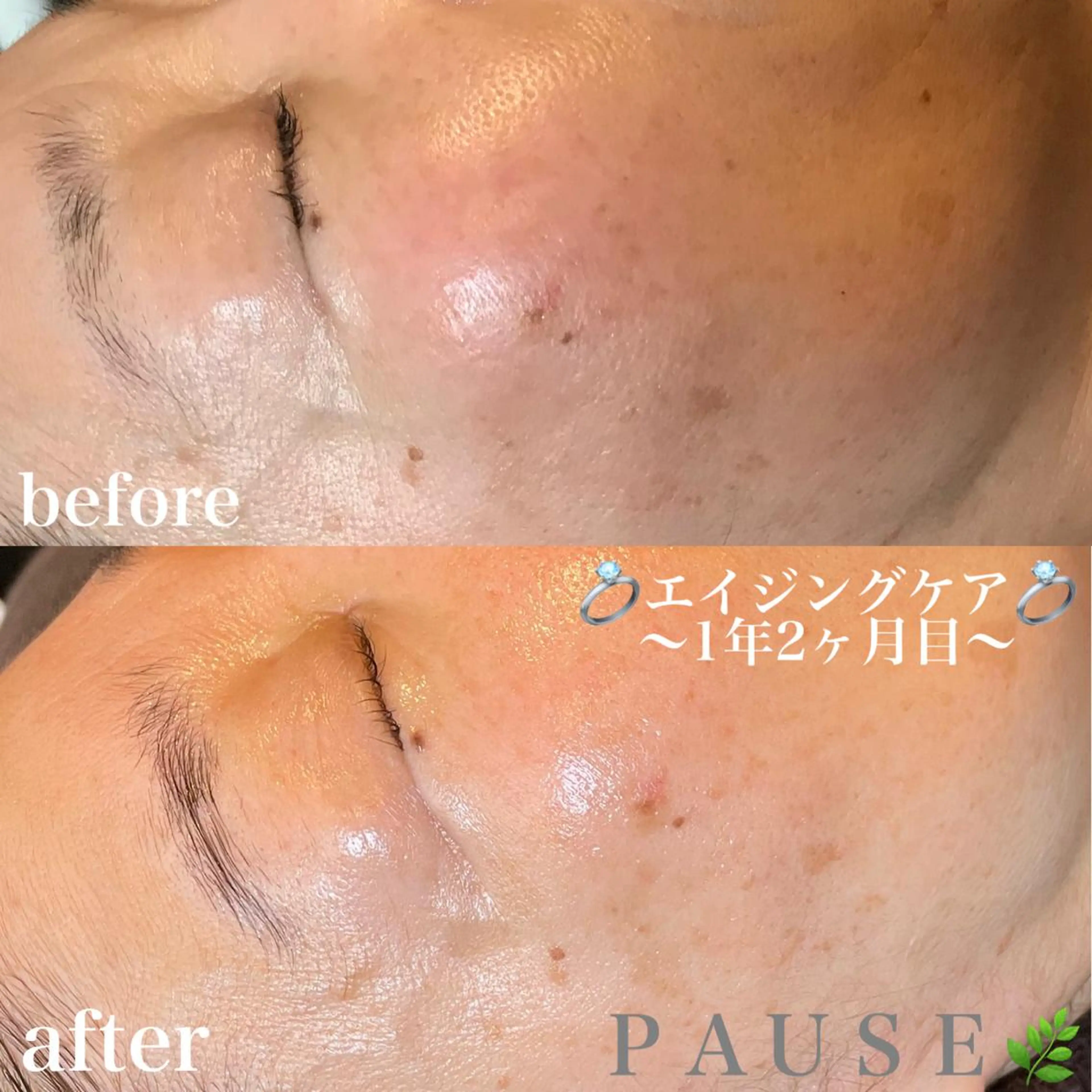 エステ 浜野 恵美のエステ・リラクイメージ