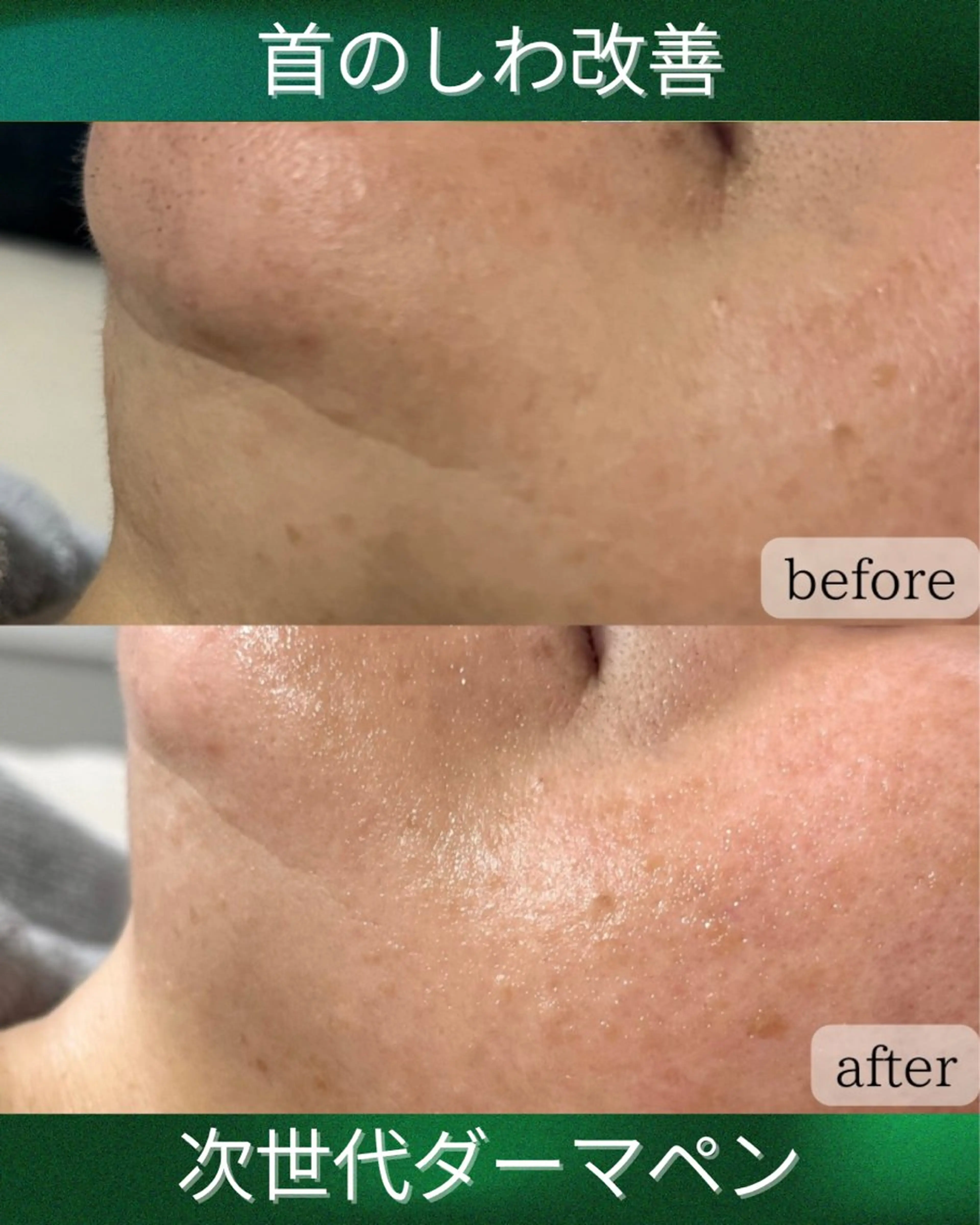 エステ Rairy Salon富士見町のエステ・リラクイメージ