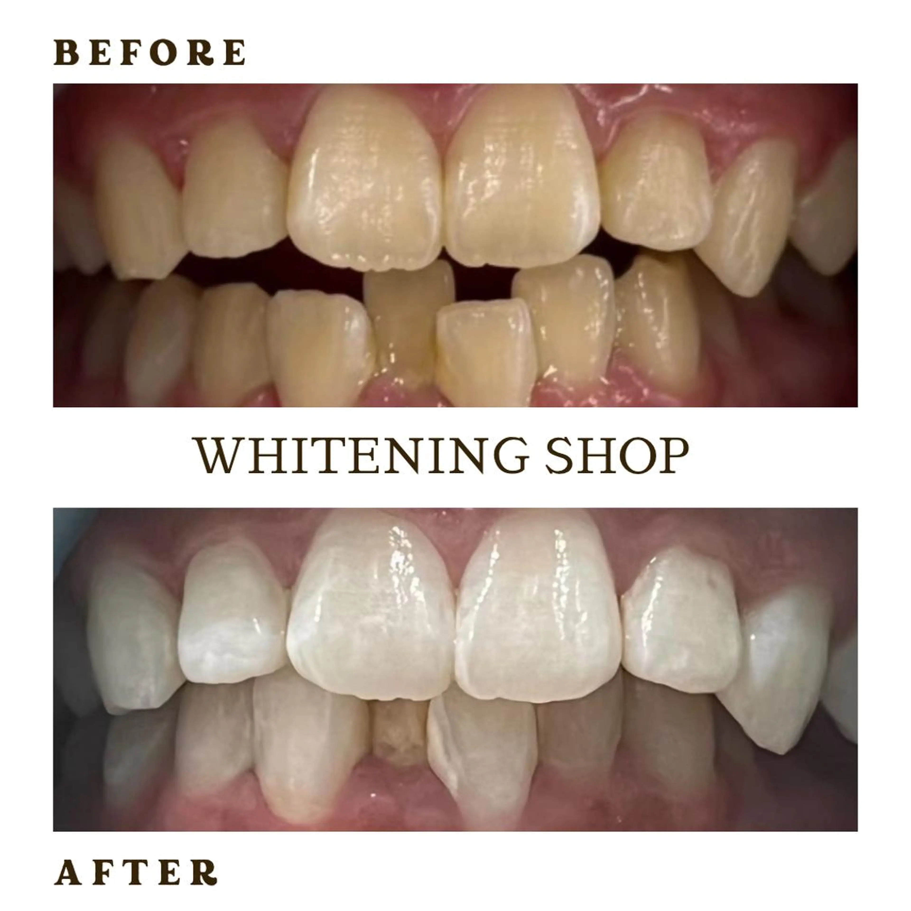 メンズ その他 ホワイトニング ショップ葛西店のその他イメージ