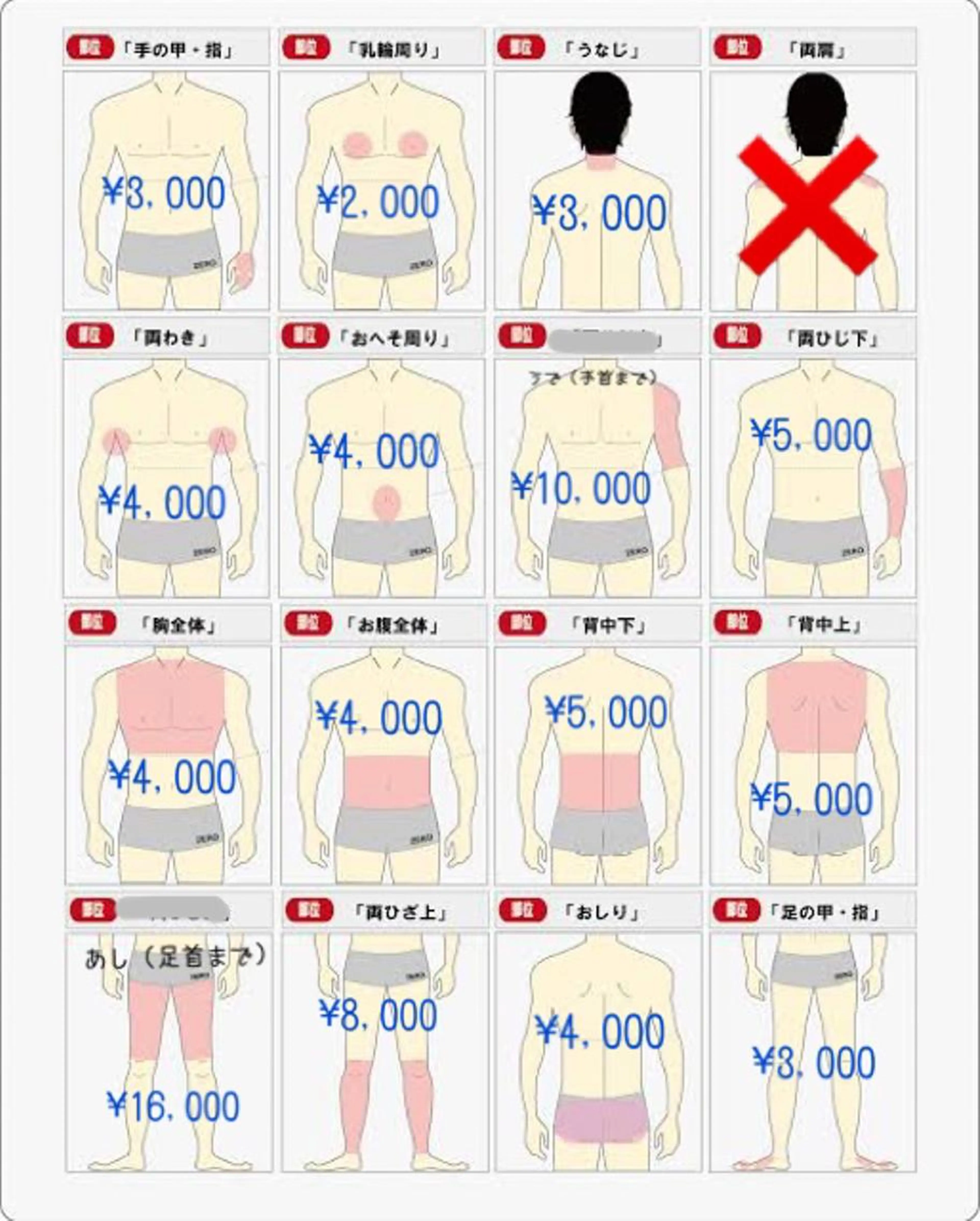 メンズ全身脱毛✨顔無しの写真